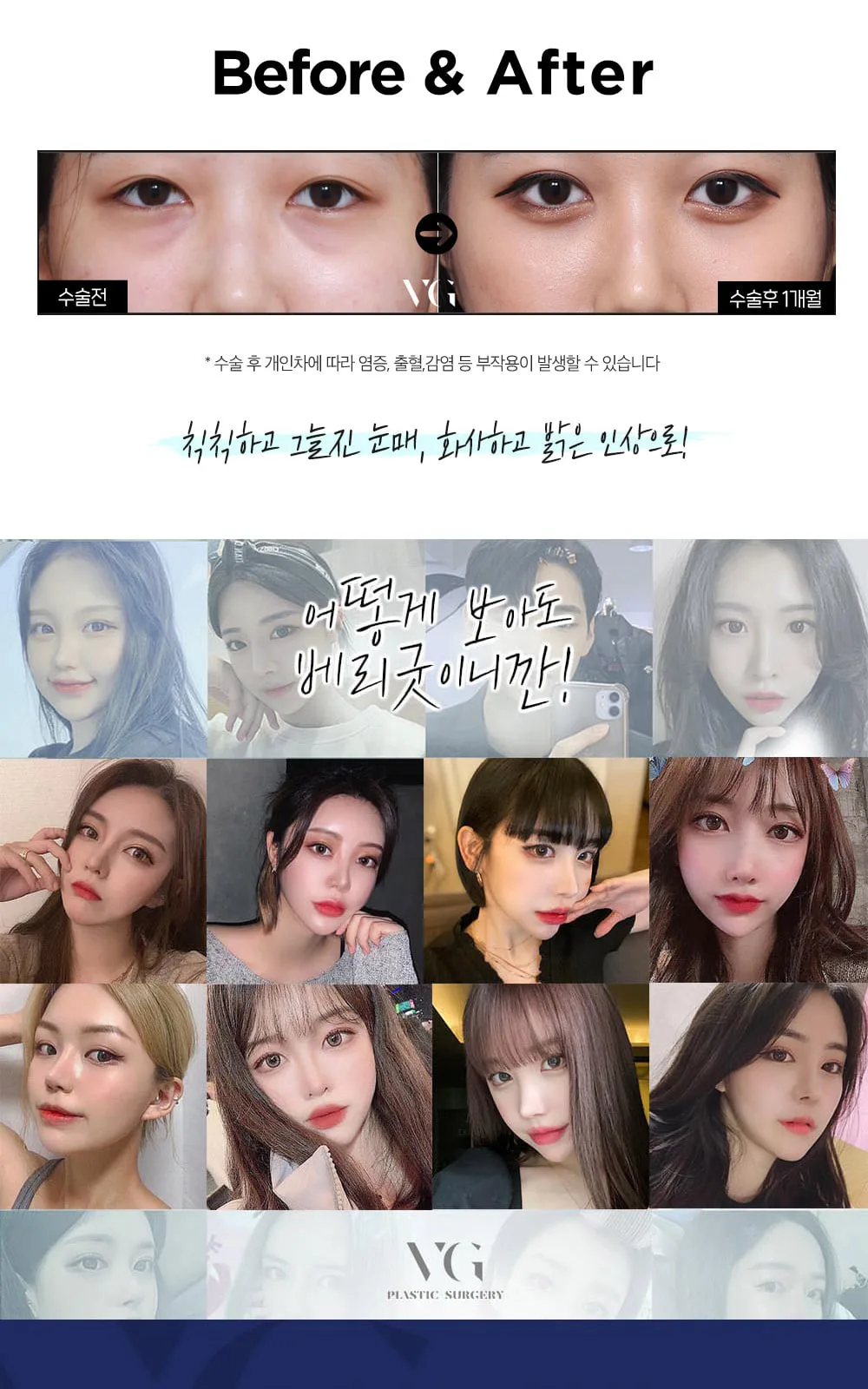 시술 상세 11