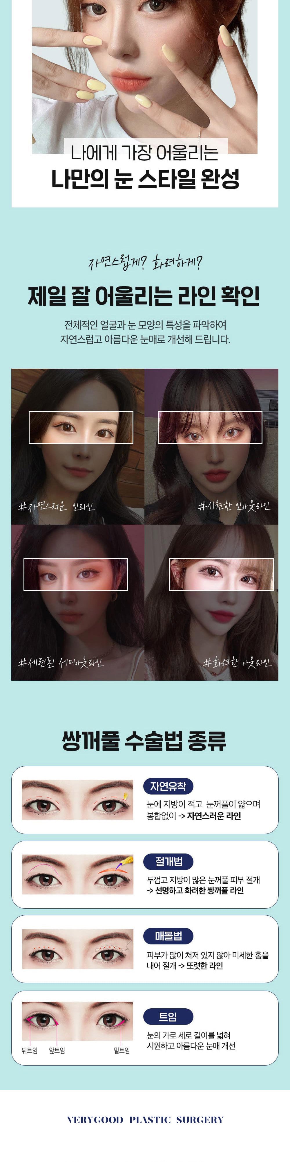 시술 상세 3