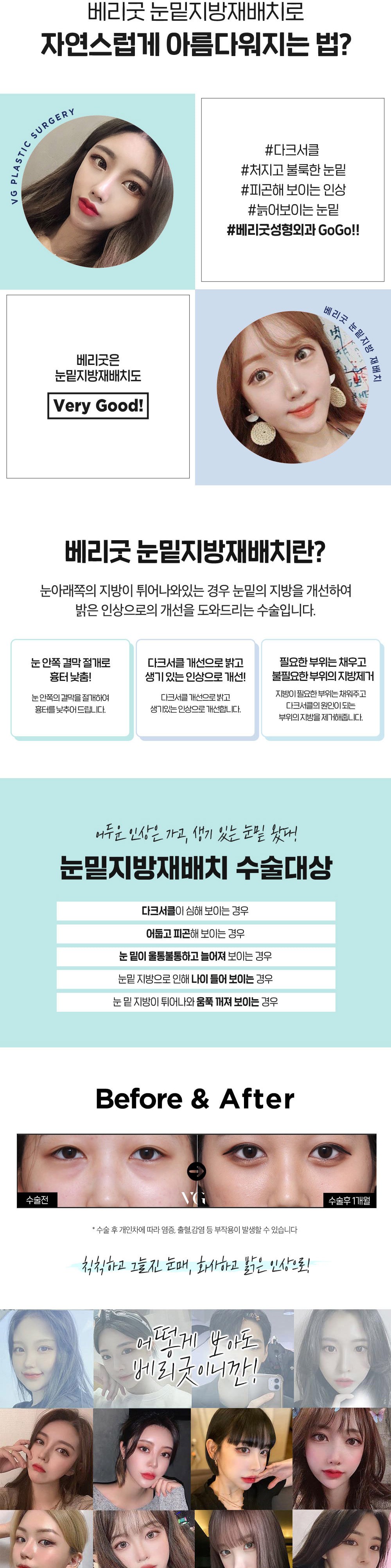 시술 상세 4
