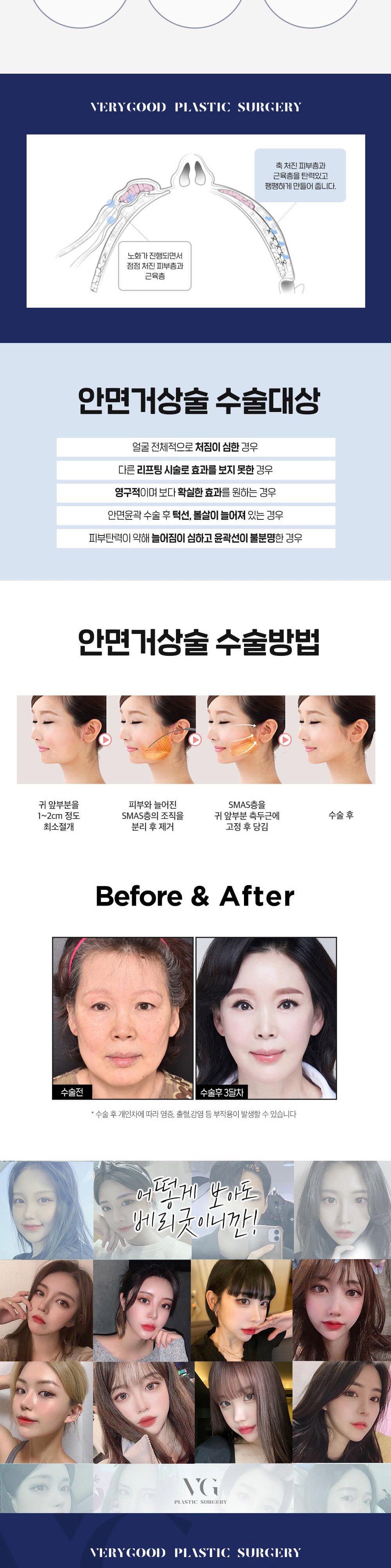 시술 상세 4
