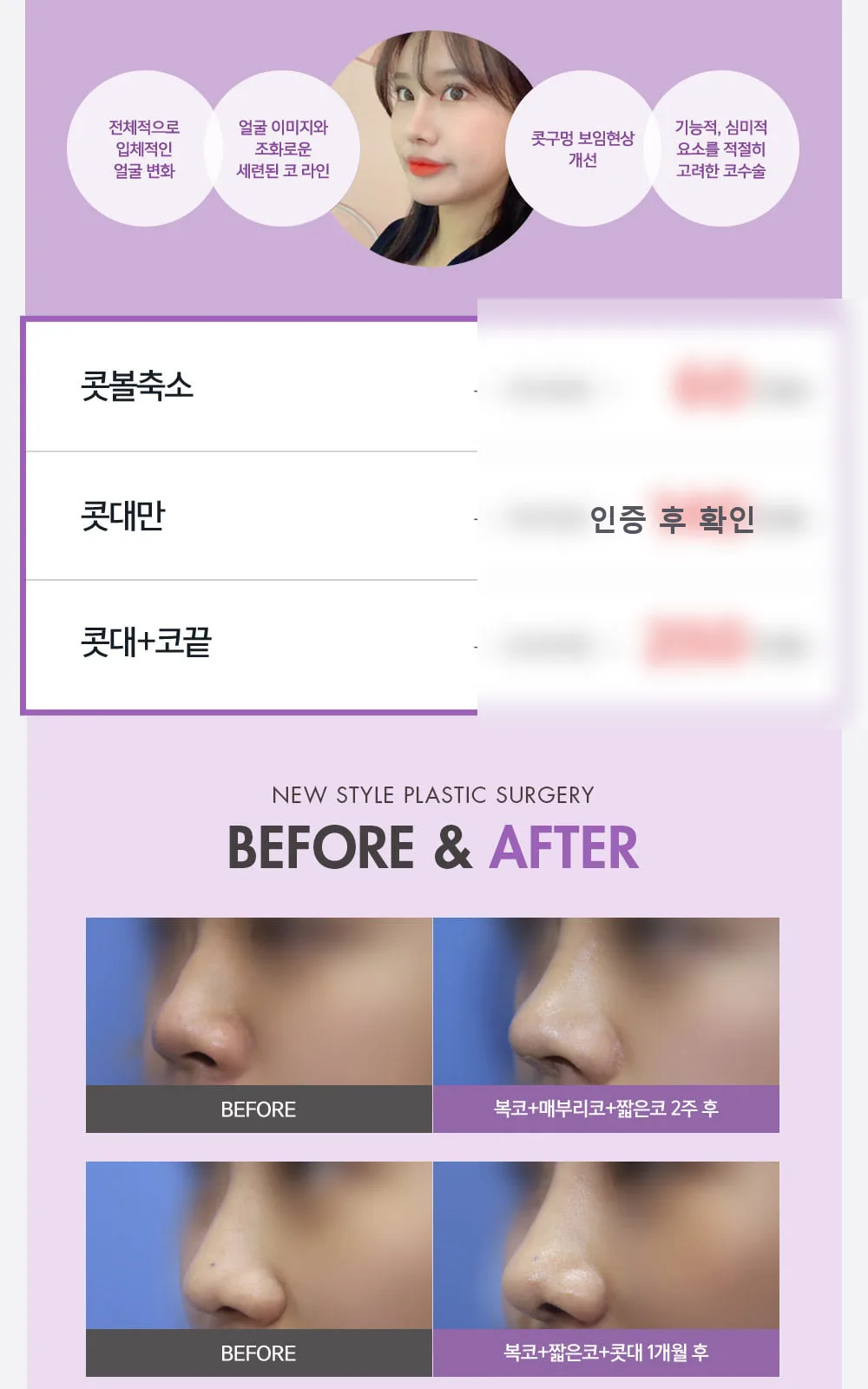 시술 상세 4