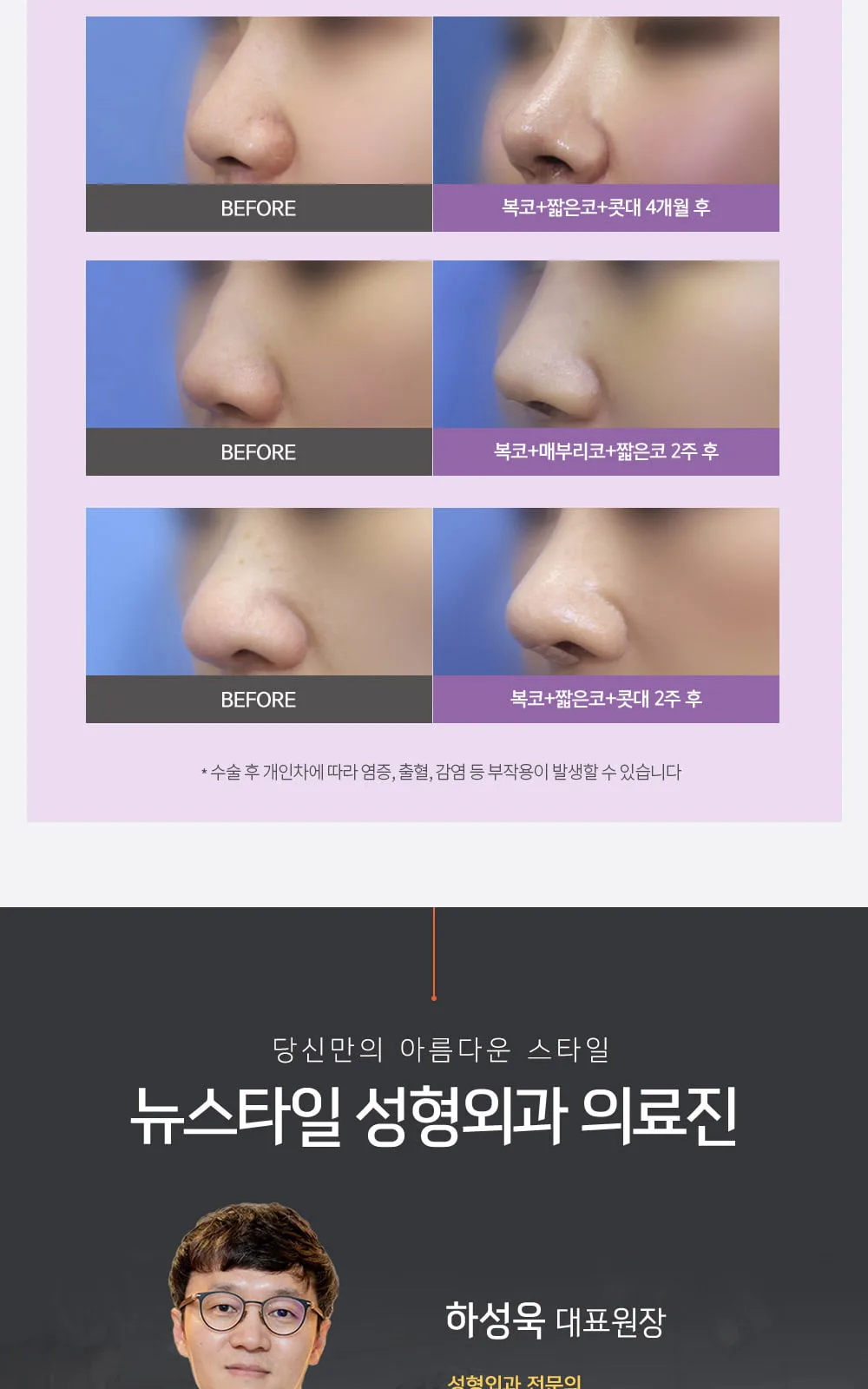 시술 상세 5
