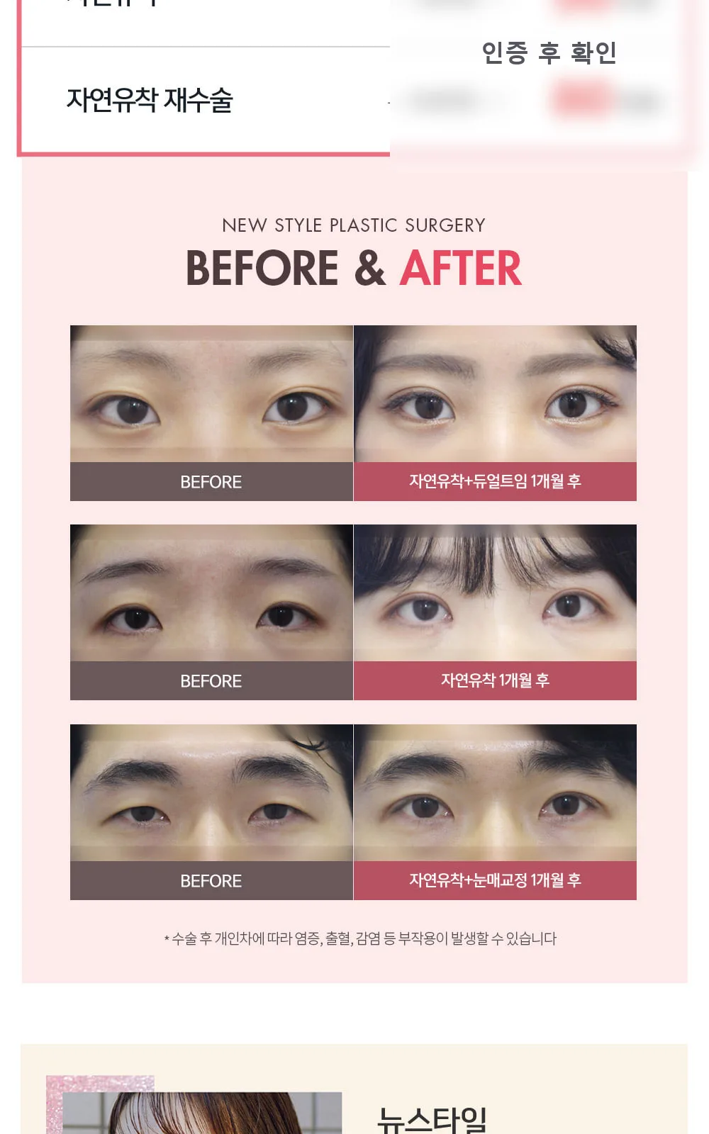 시술 상세 4