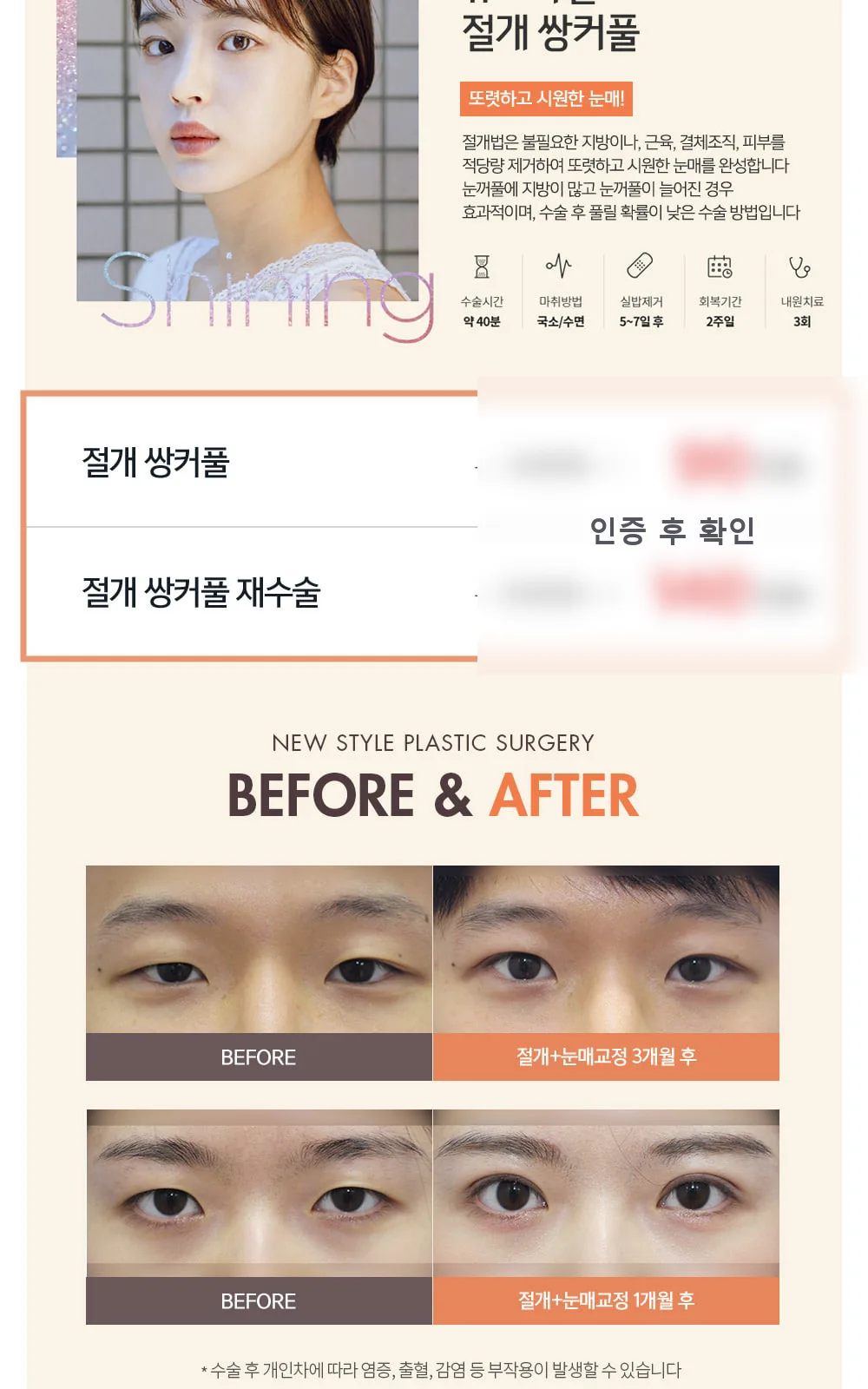 시술 상세 5