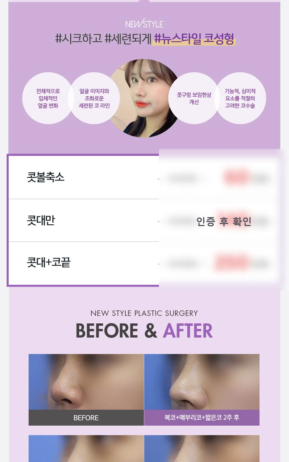 시술 상세 9