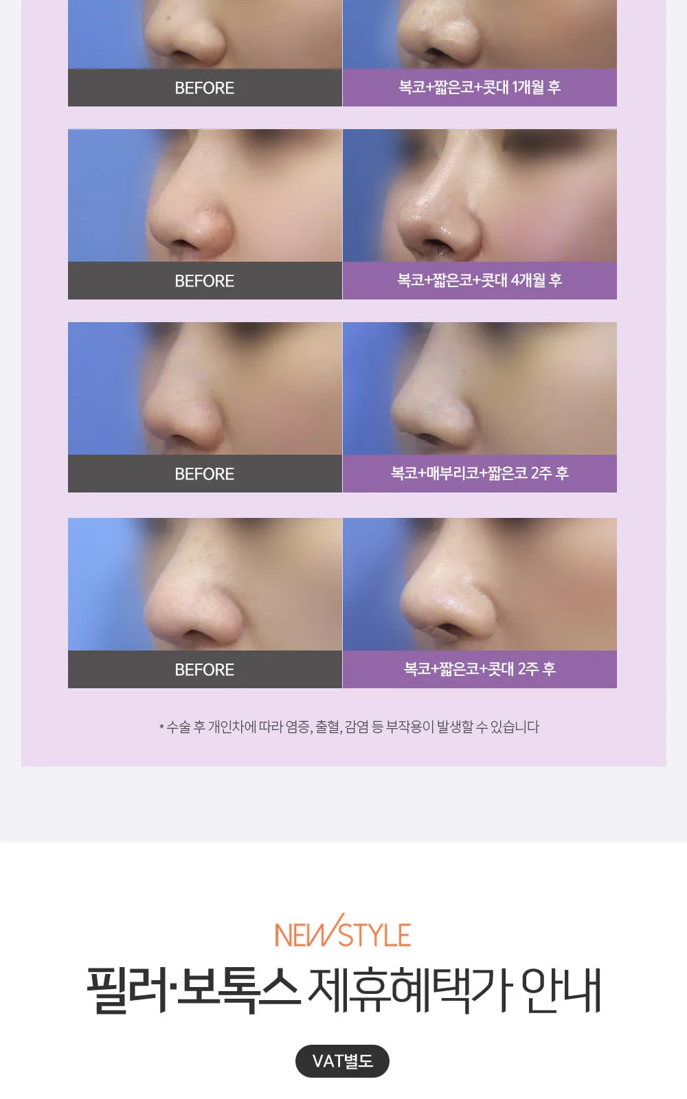 시술 상세 10