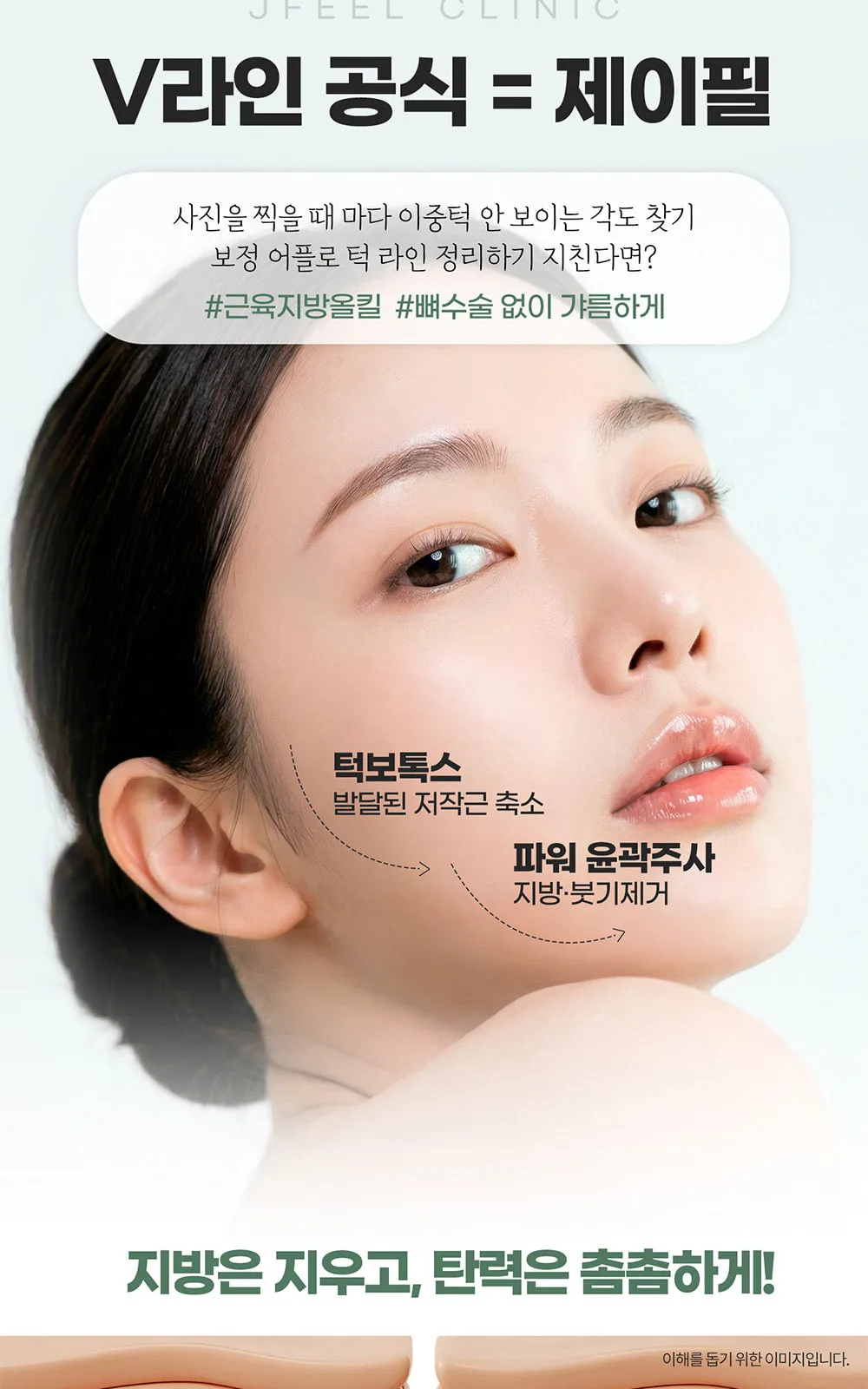 시술 상세 7