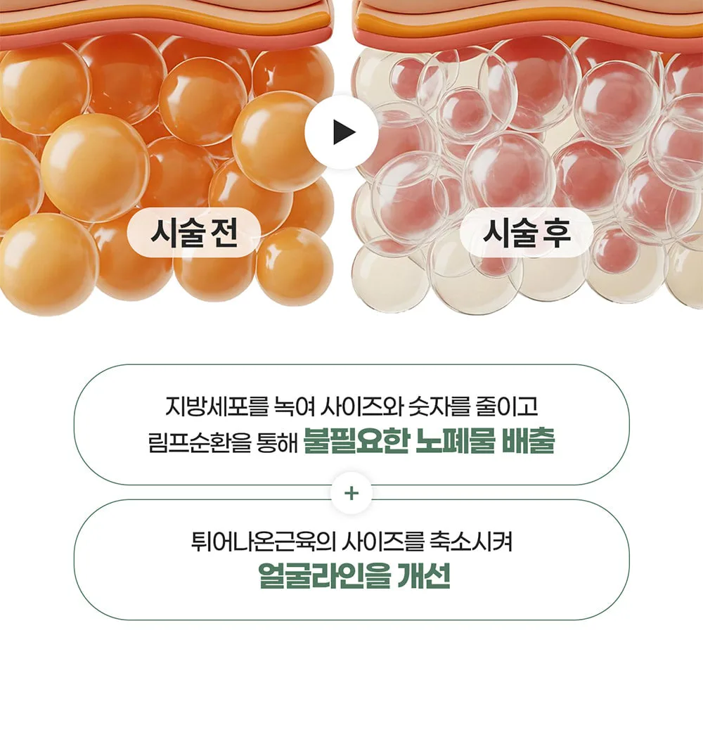 시술 상세 8