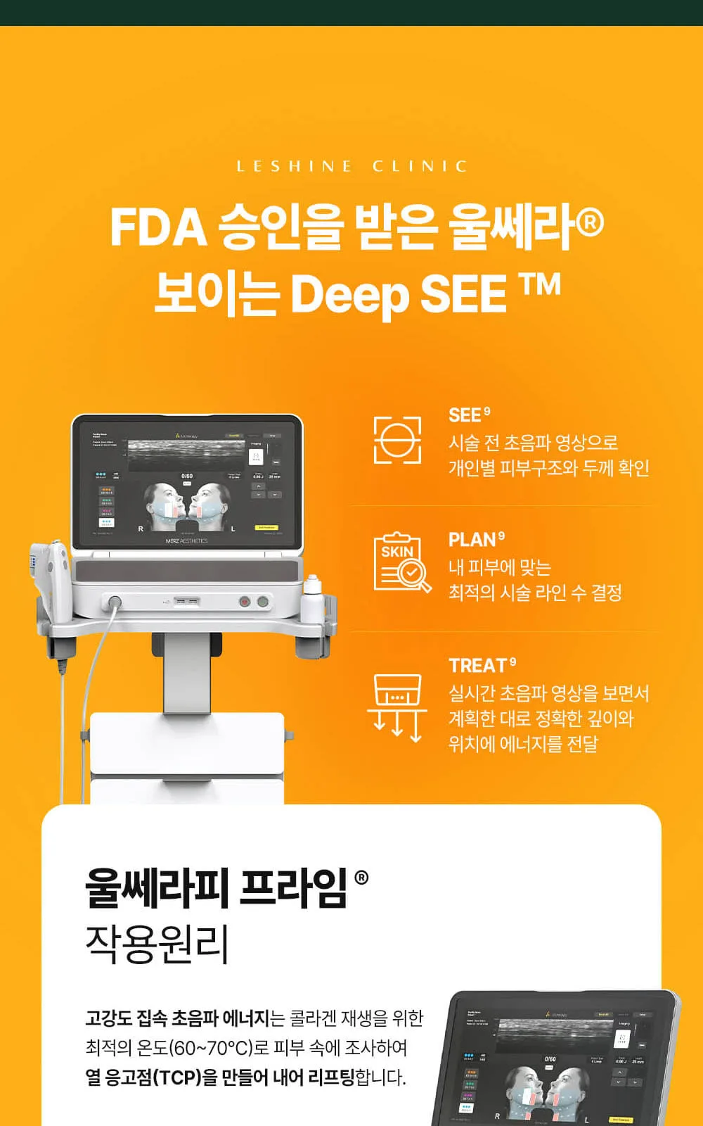 시술 상세 5