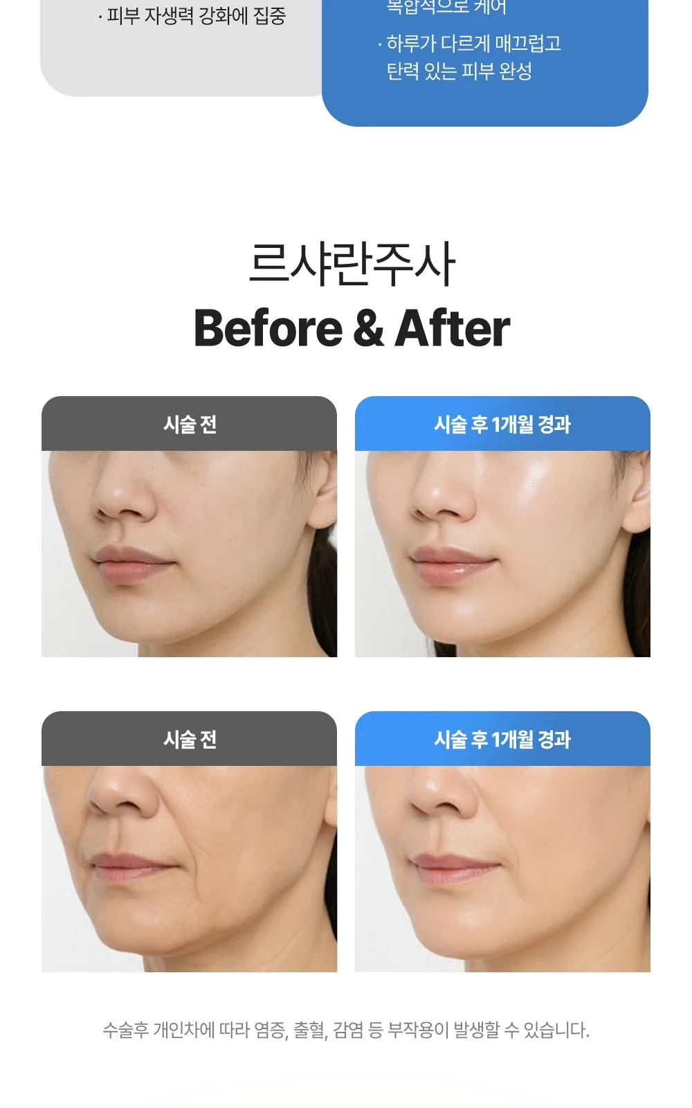 시술 상세 12