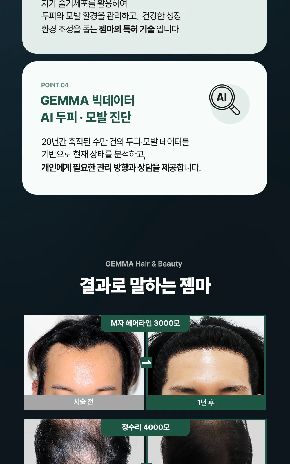 시술 상세 4