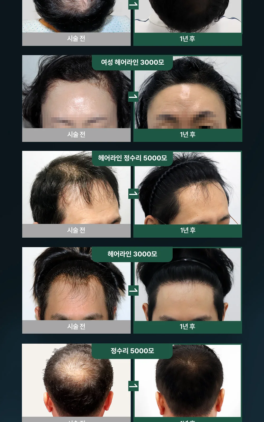 시술 상세 5