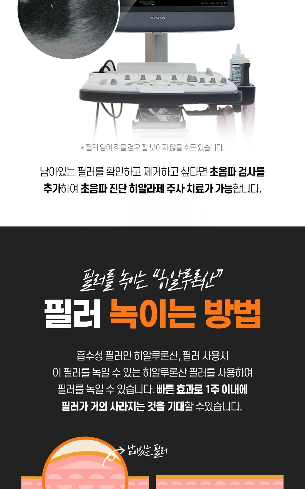 시술 상세 4