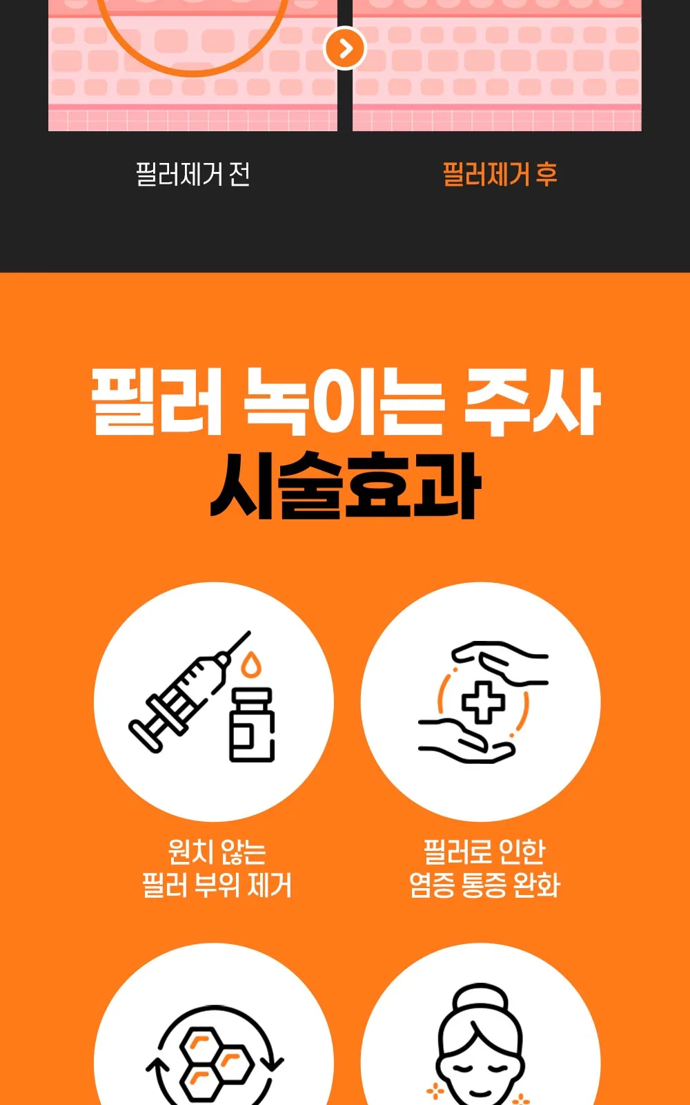 시술 상세 5