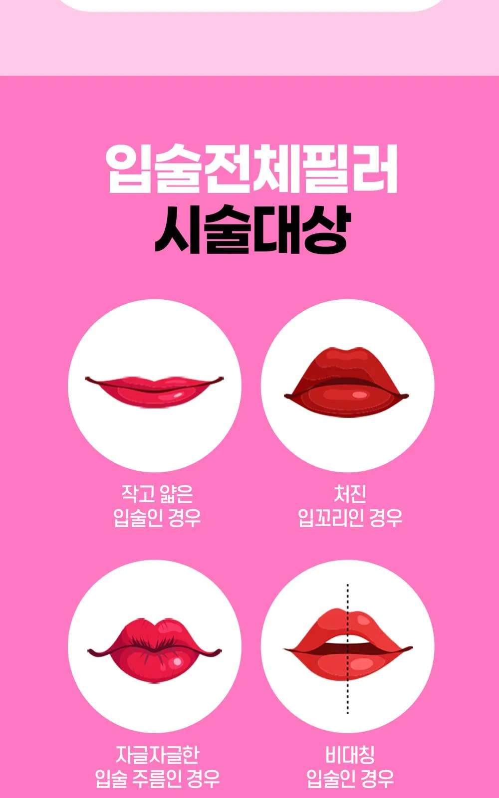 시술 상세 5