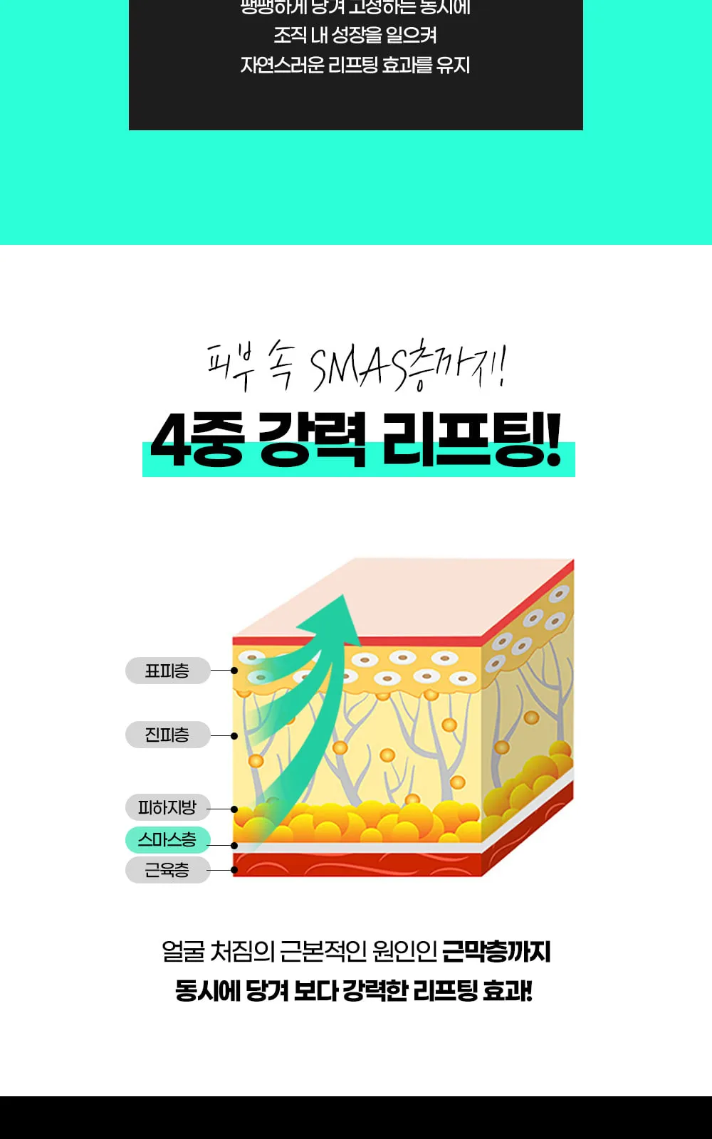 시술 상세 7