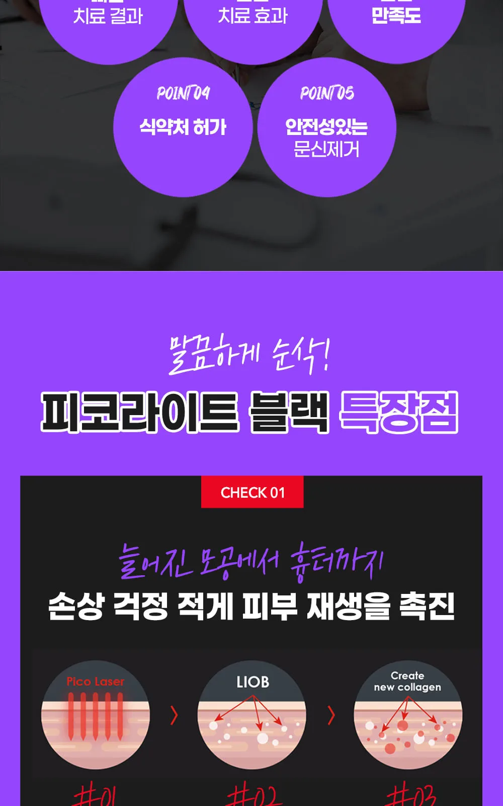 시술 상세 4