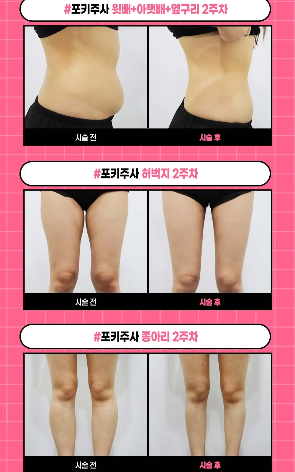 시술 상세 6