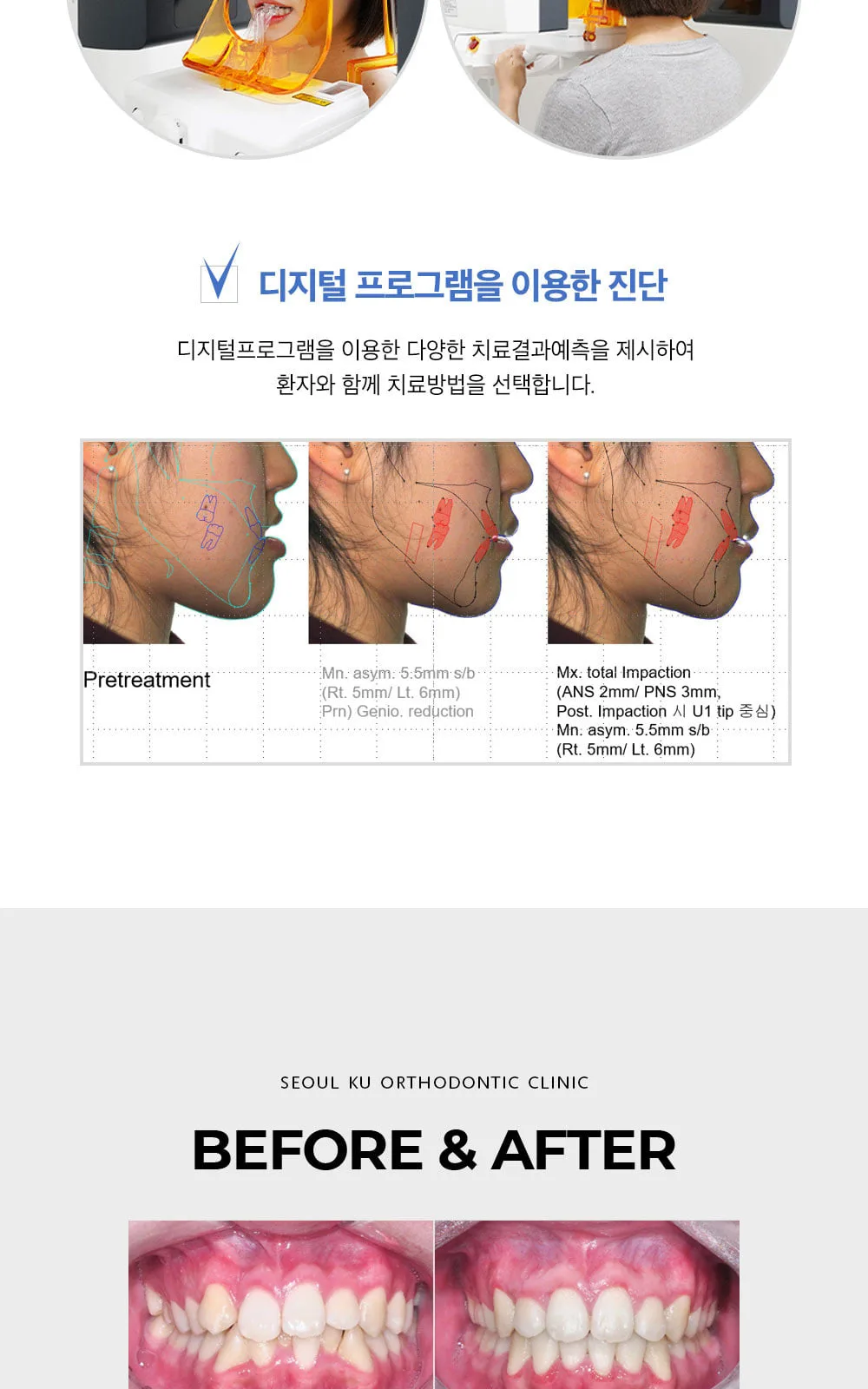 시술 상세 5