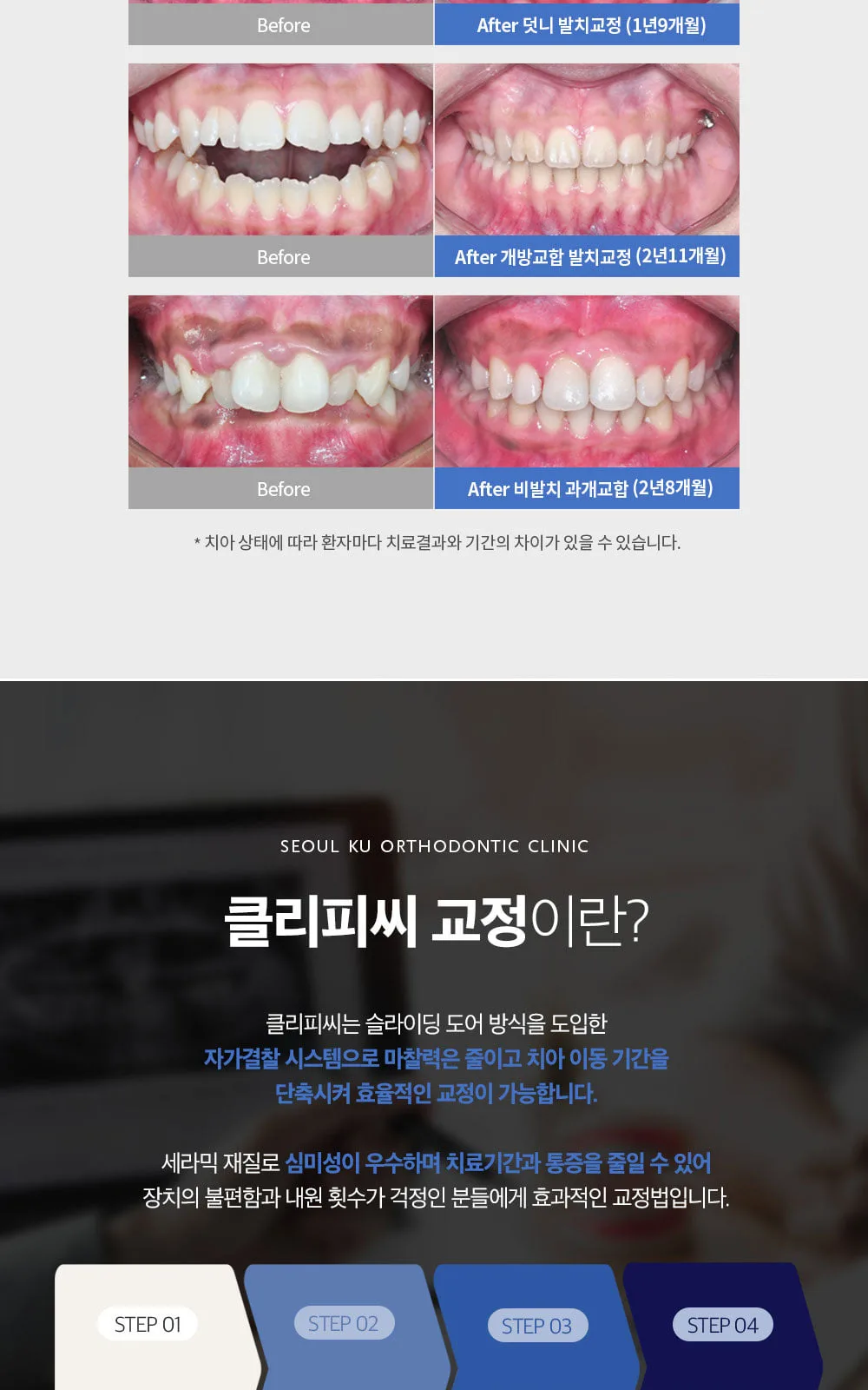 시술 상세 6