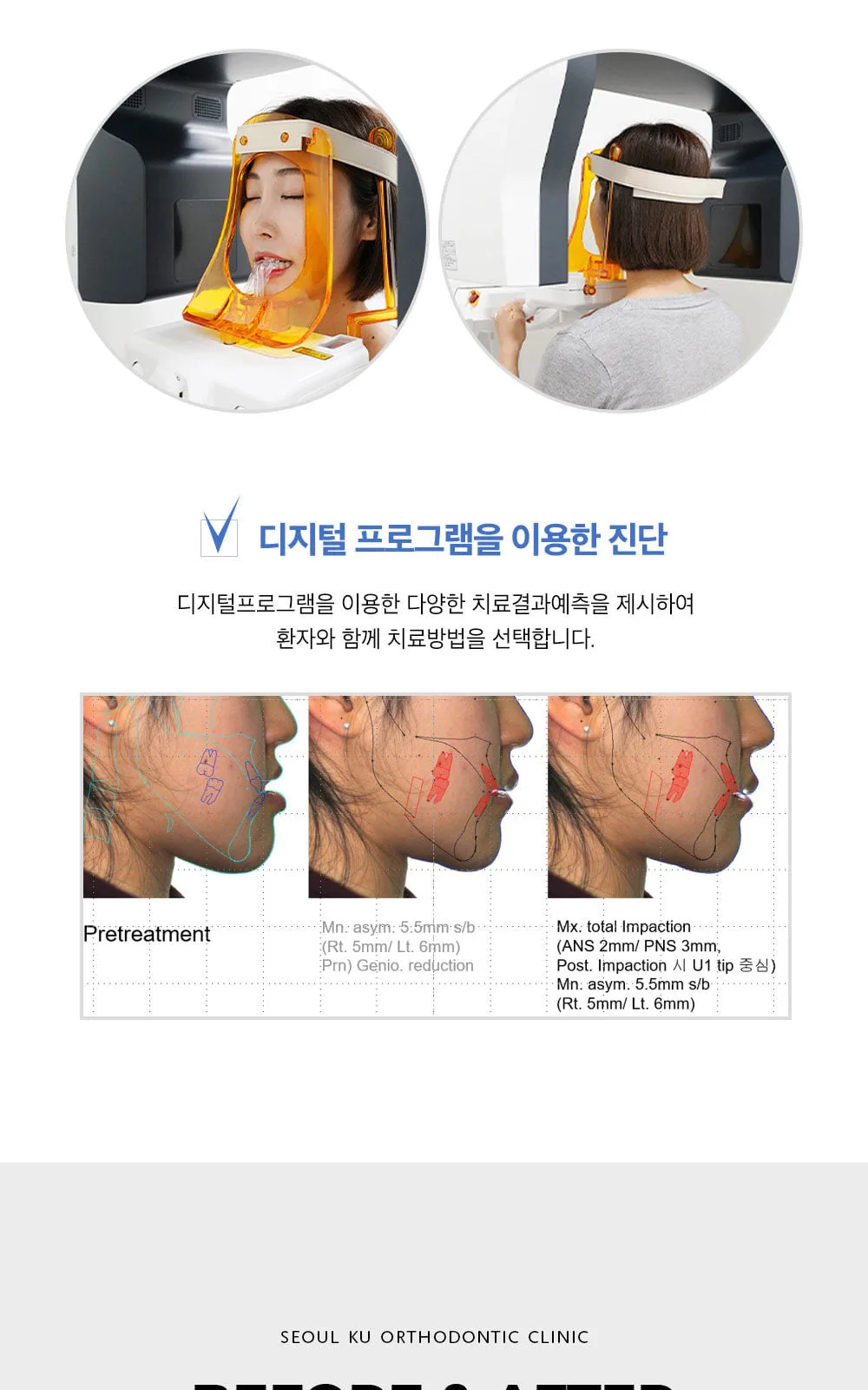 시술 상세 4