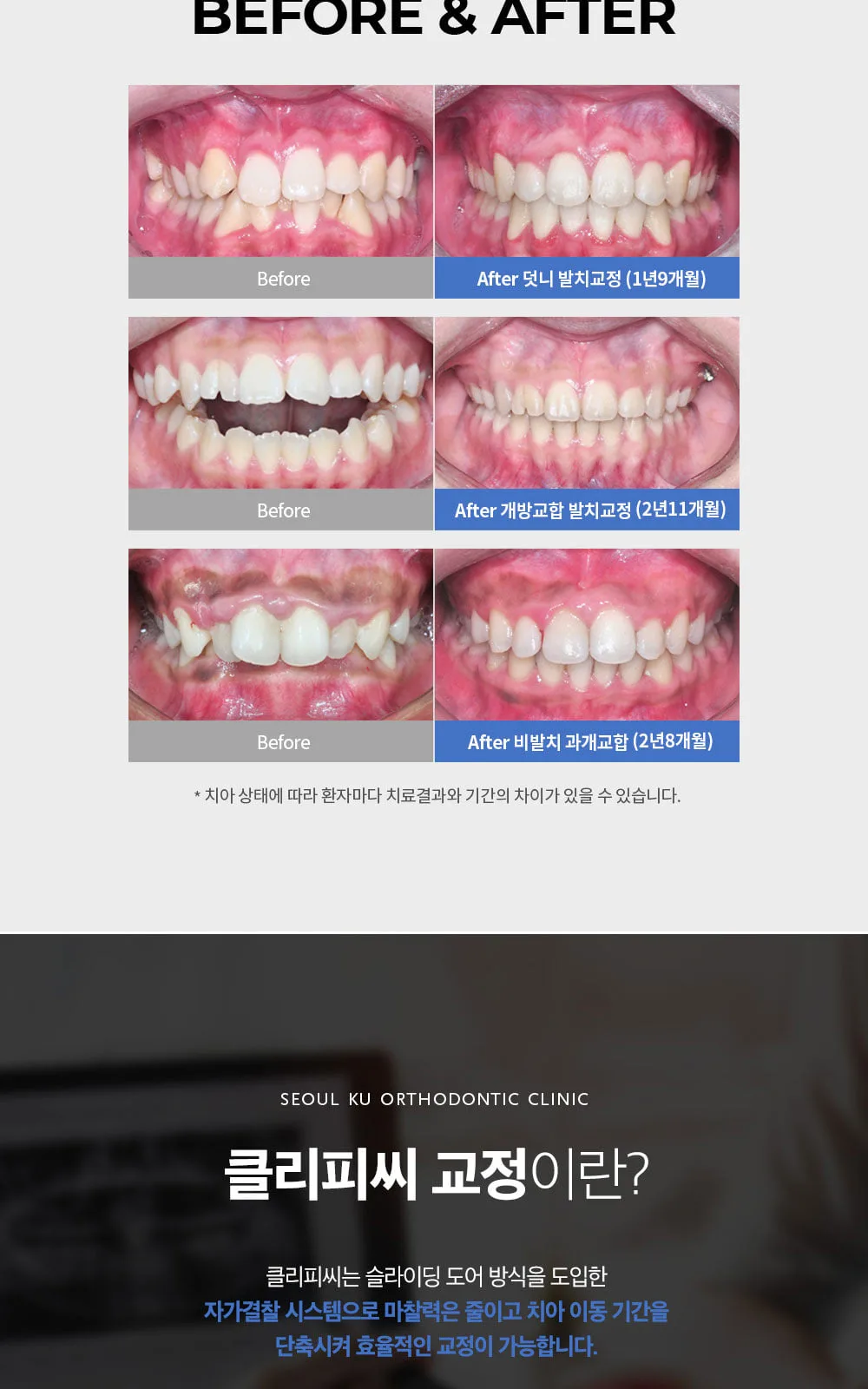 시술 상세 5