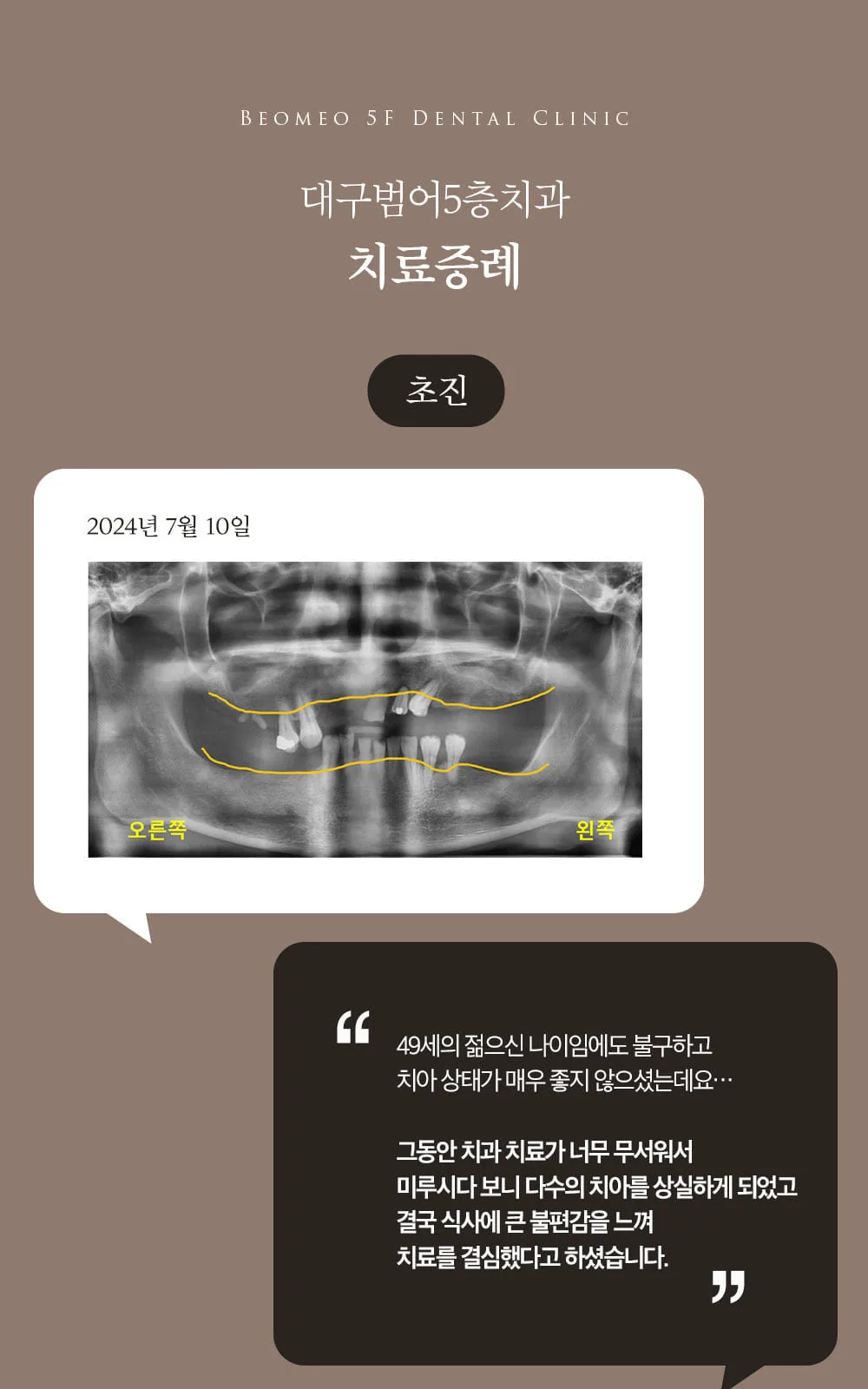 시술 상세 5