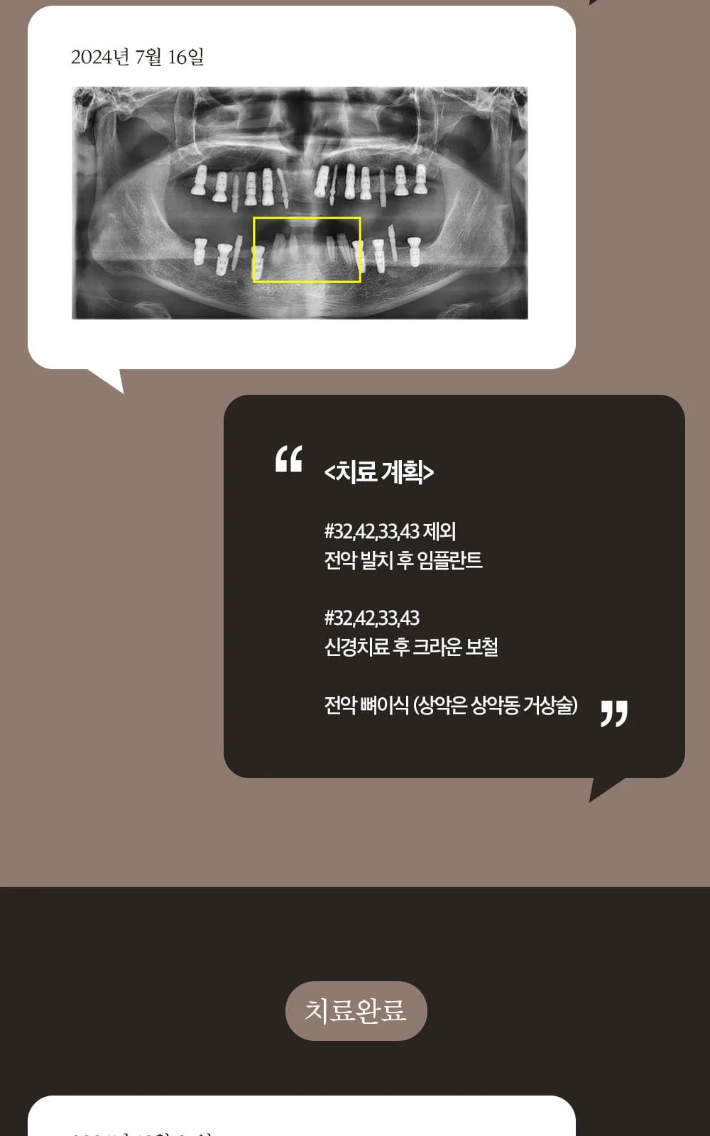 시술 상세 6