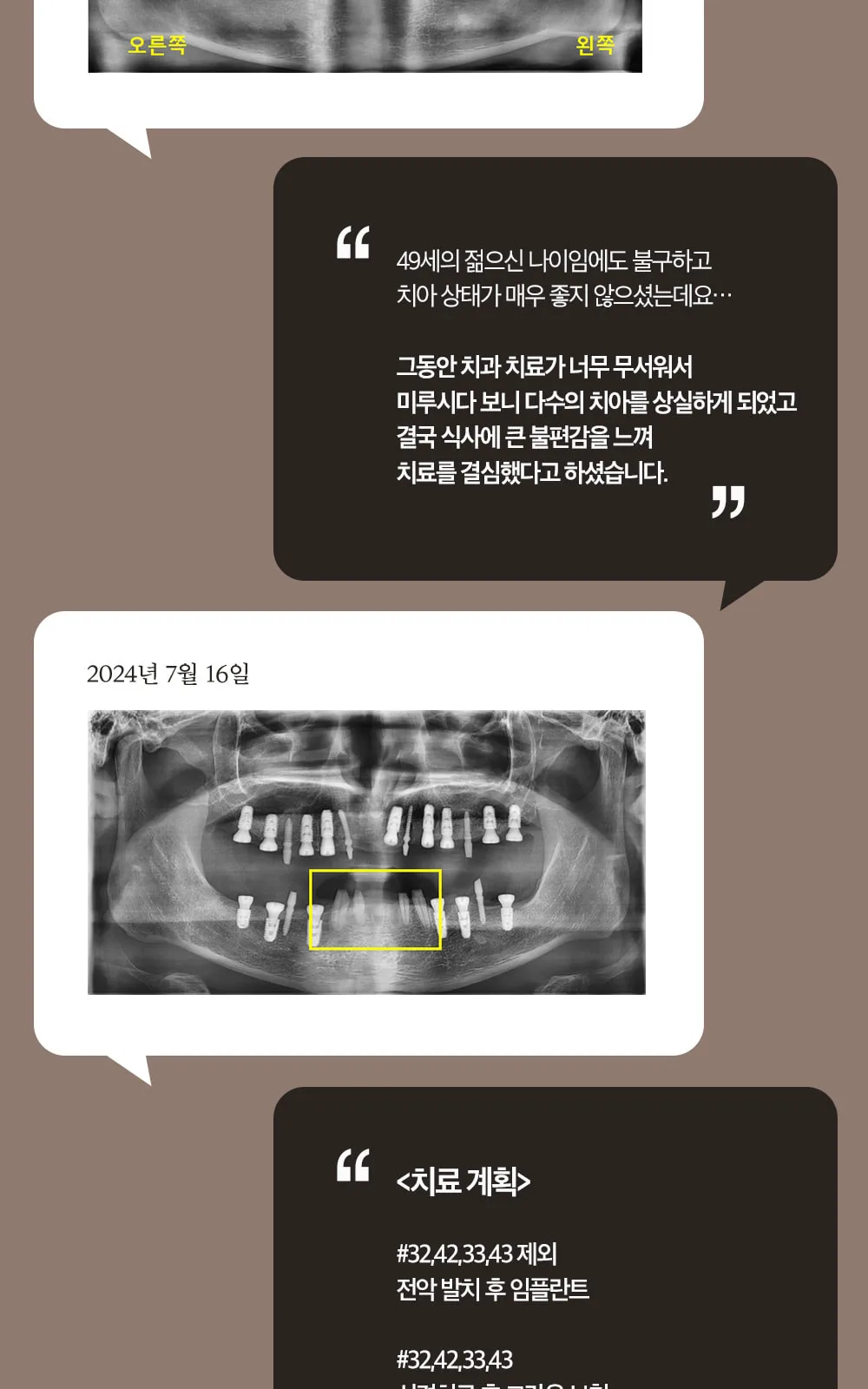 시술 상세 7