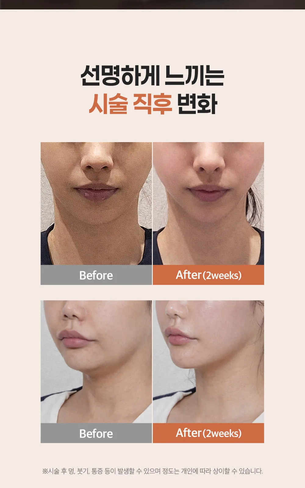 시술 상세 6