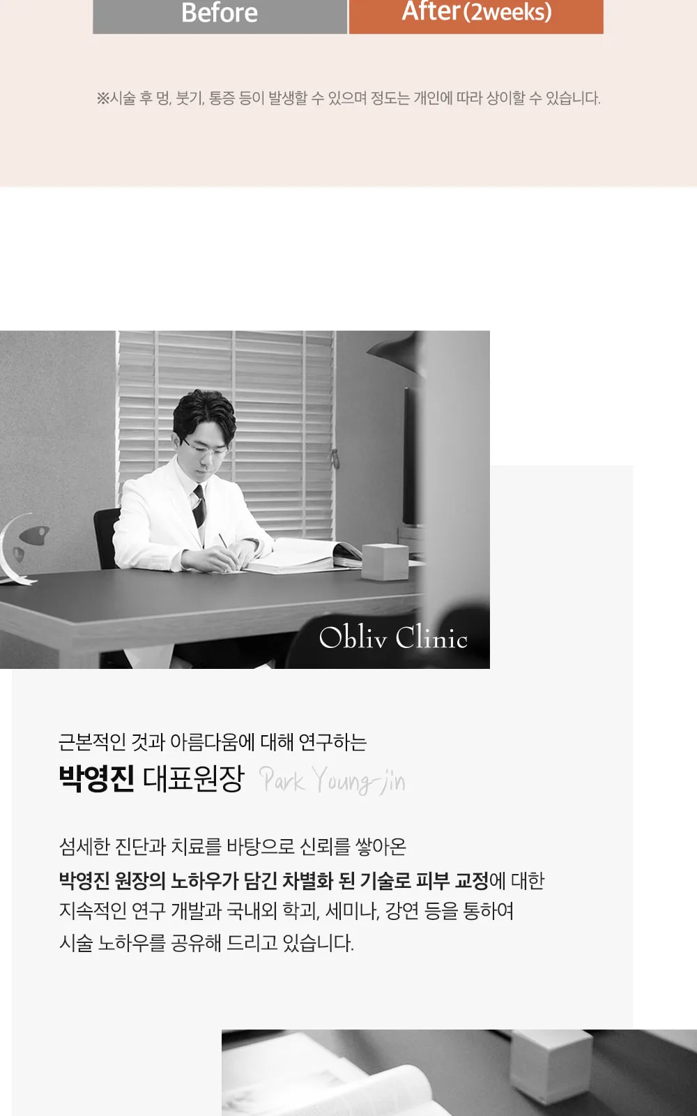 시술 상세 8