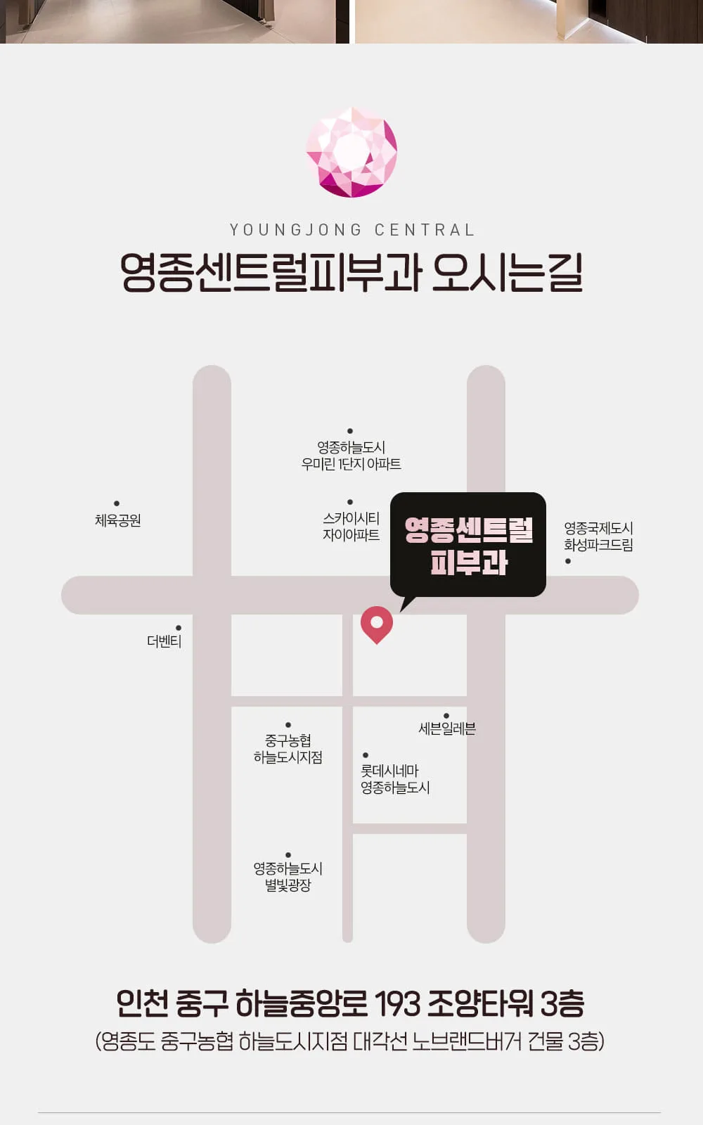 시술 상세 8