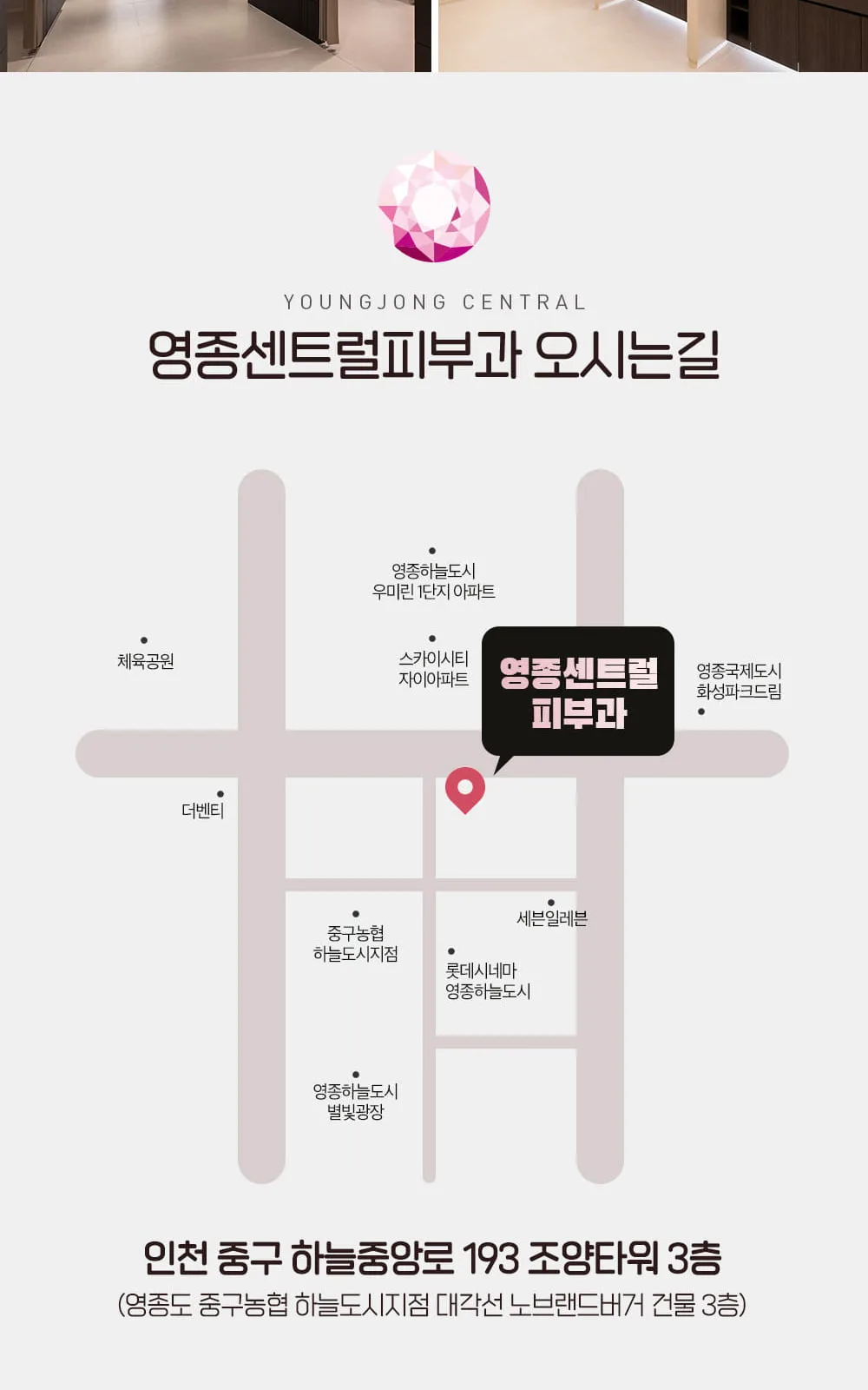 시술 상세 8