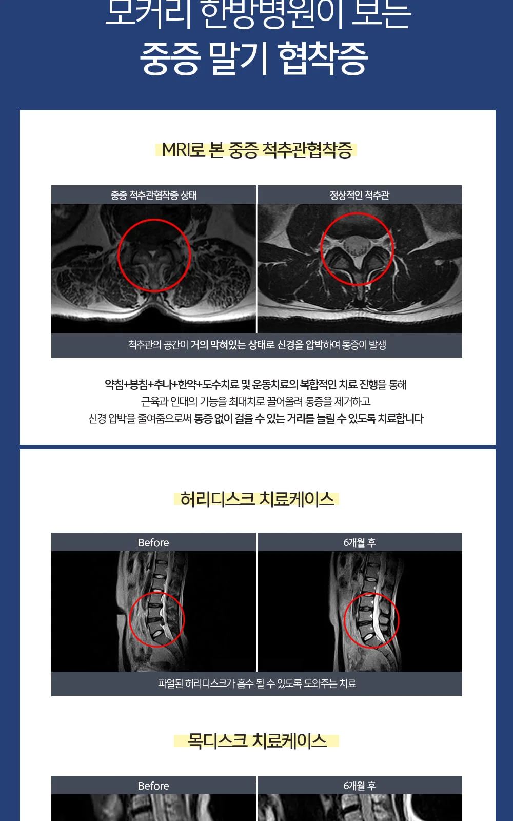 시술 상세 5