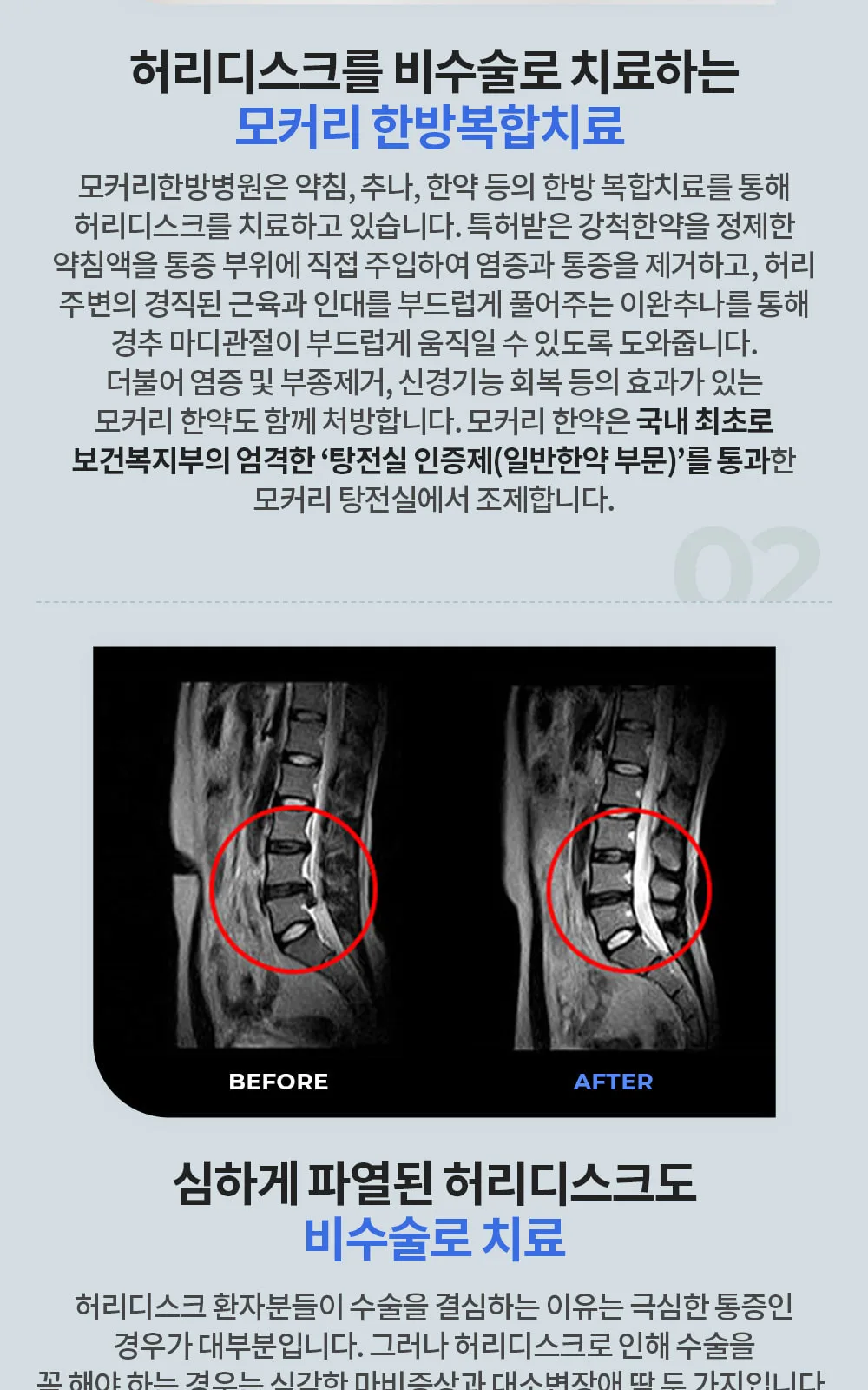시술 상세 4