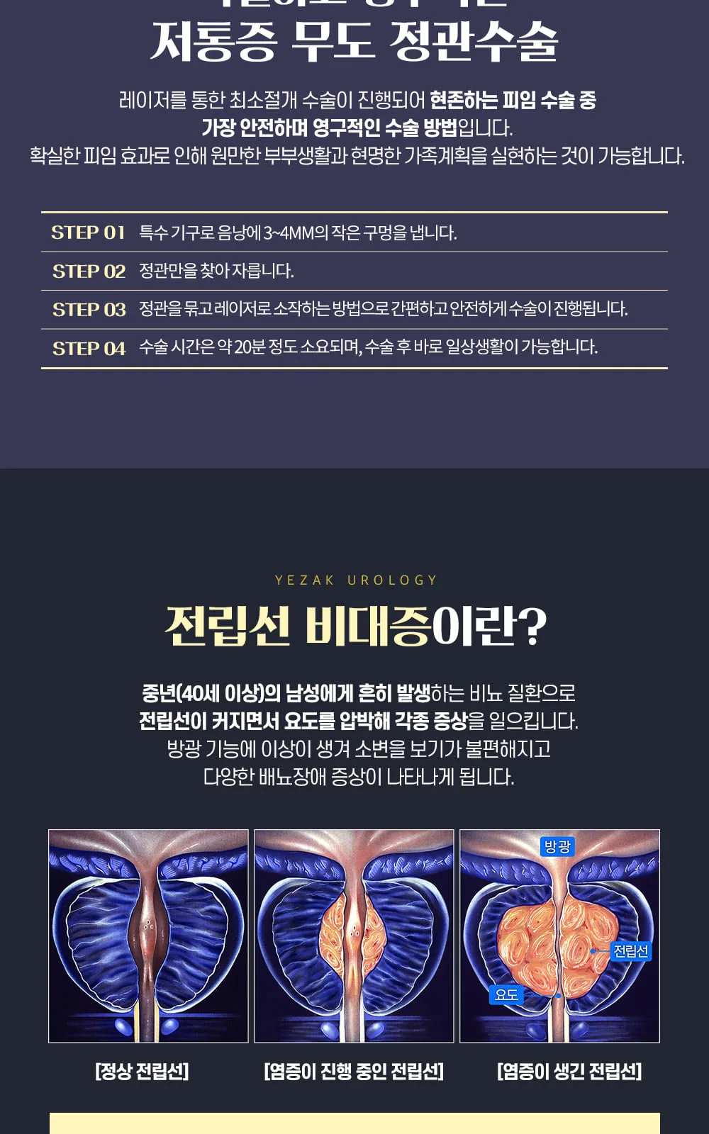 시술 상세 5