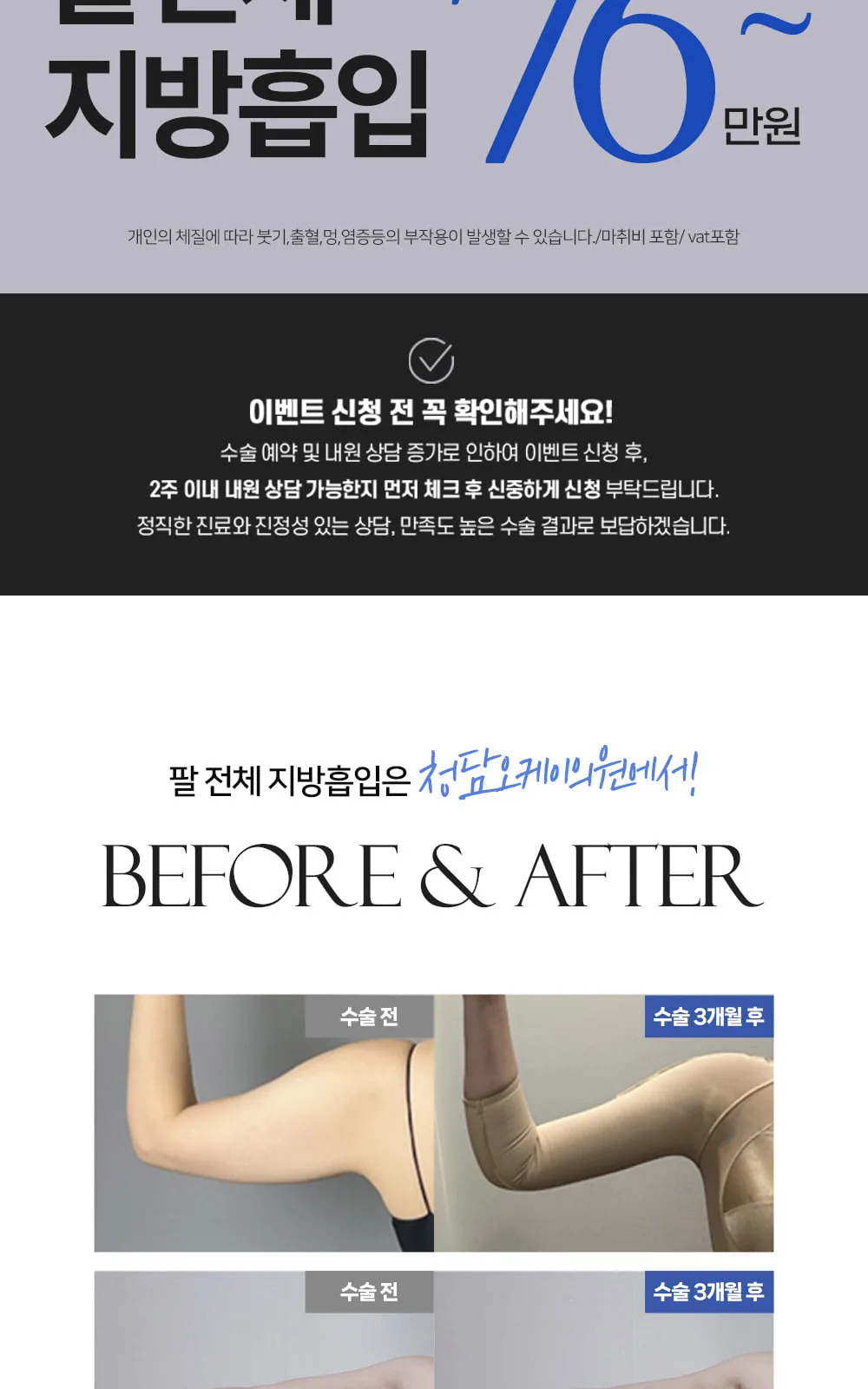 시술 상세 2