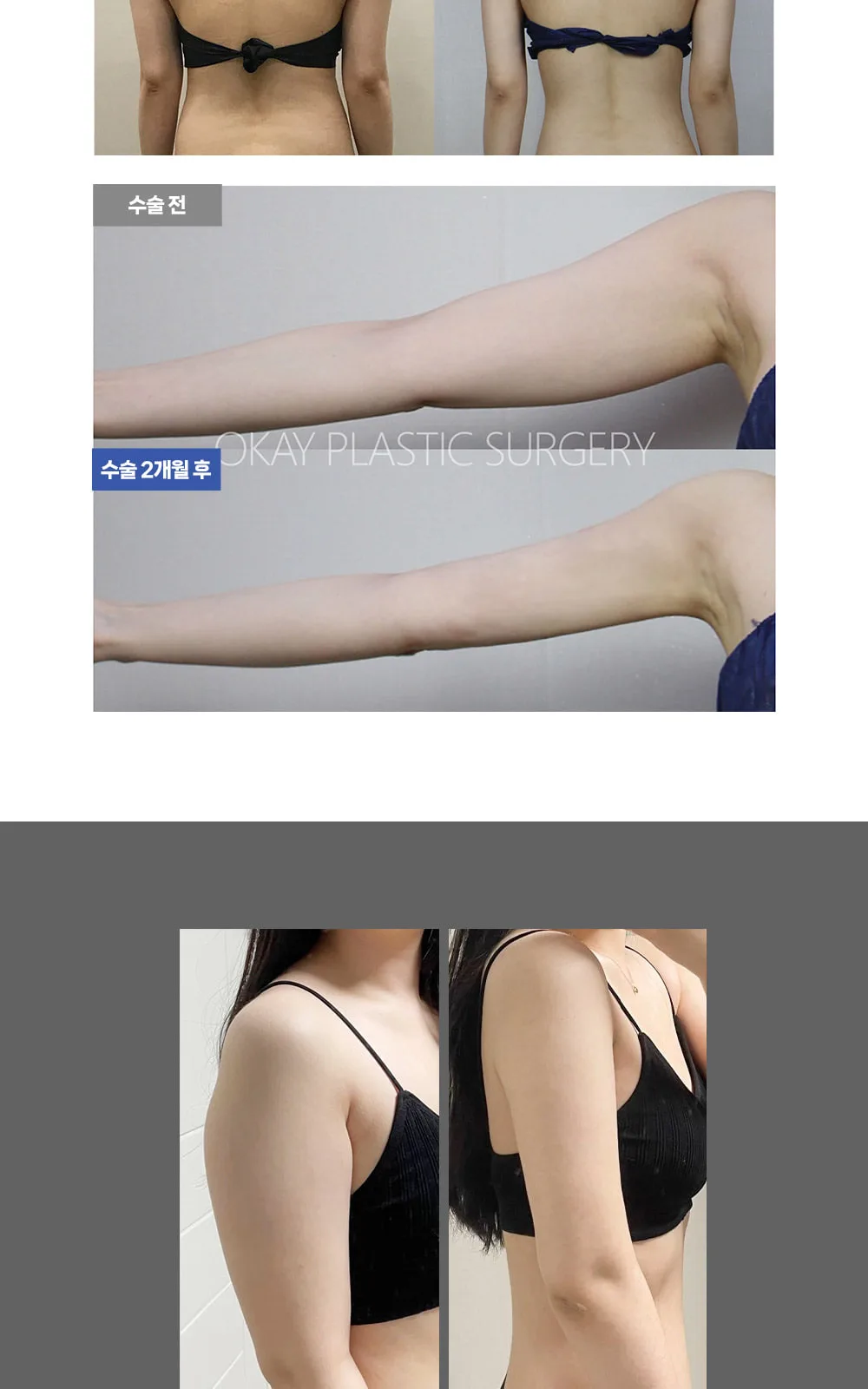 시술 상세 4