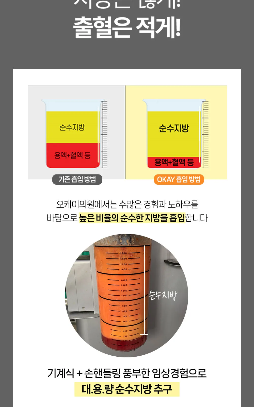 시술 상세 12