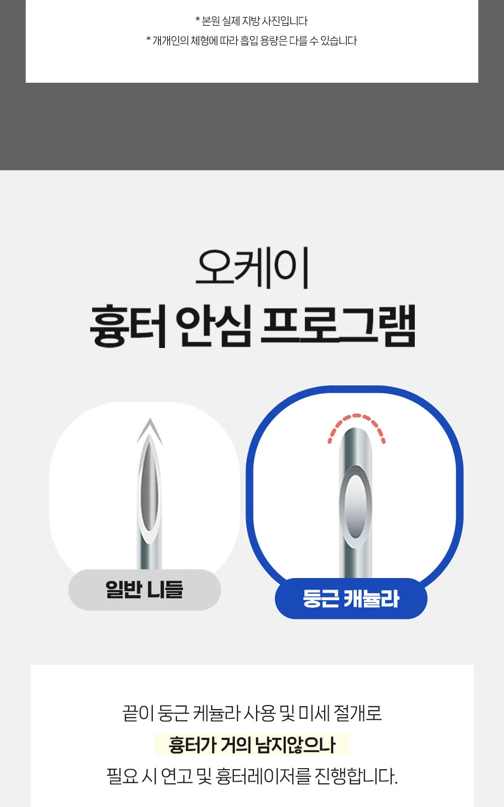 시술 상세 13