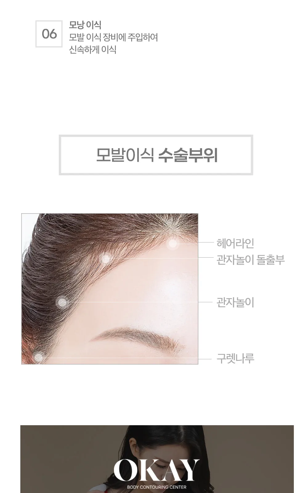 시술 상세 7