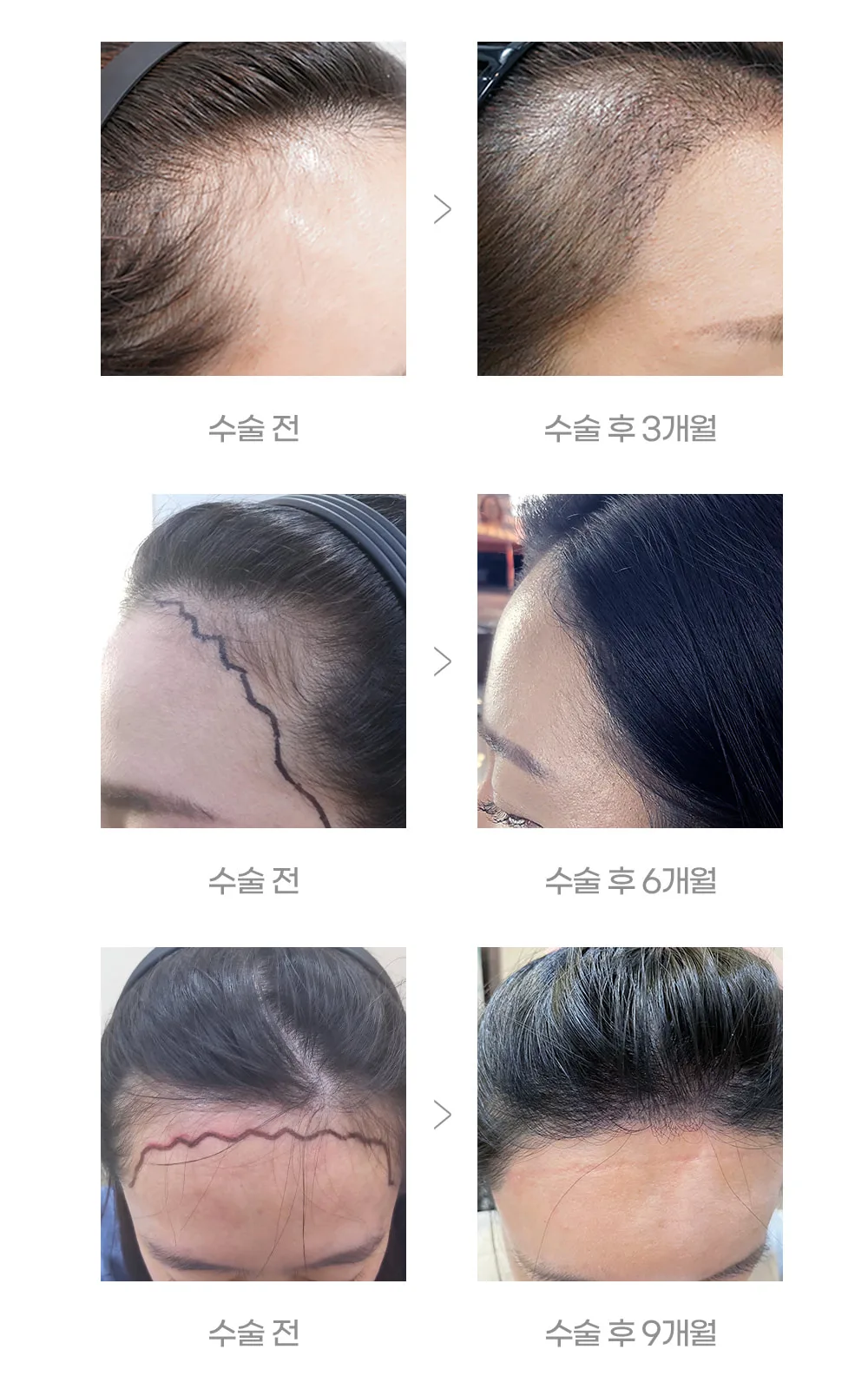 시술 상세 9