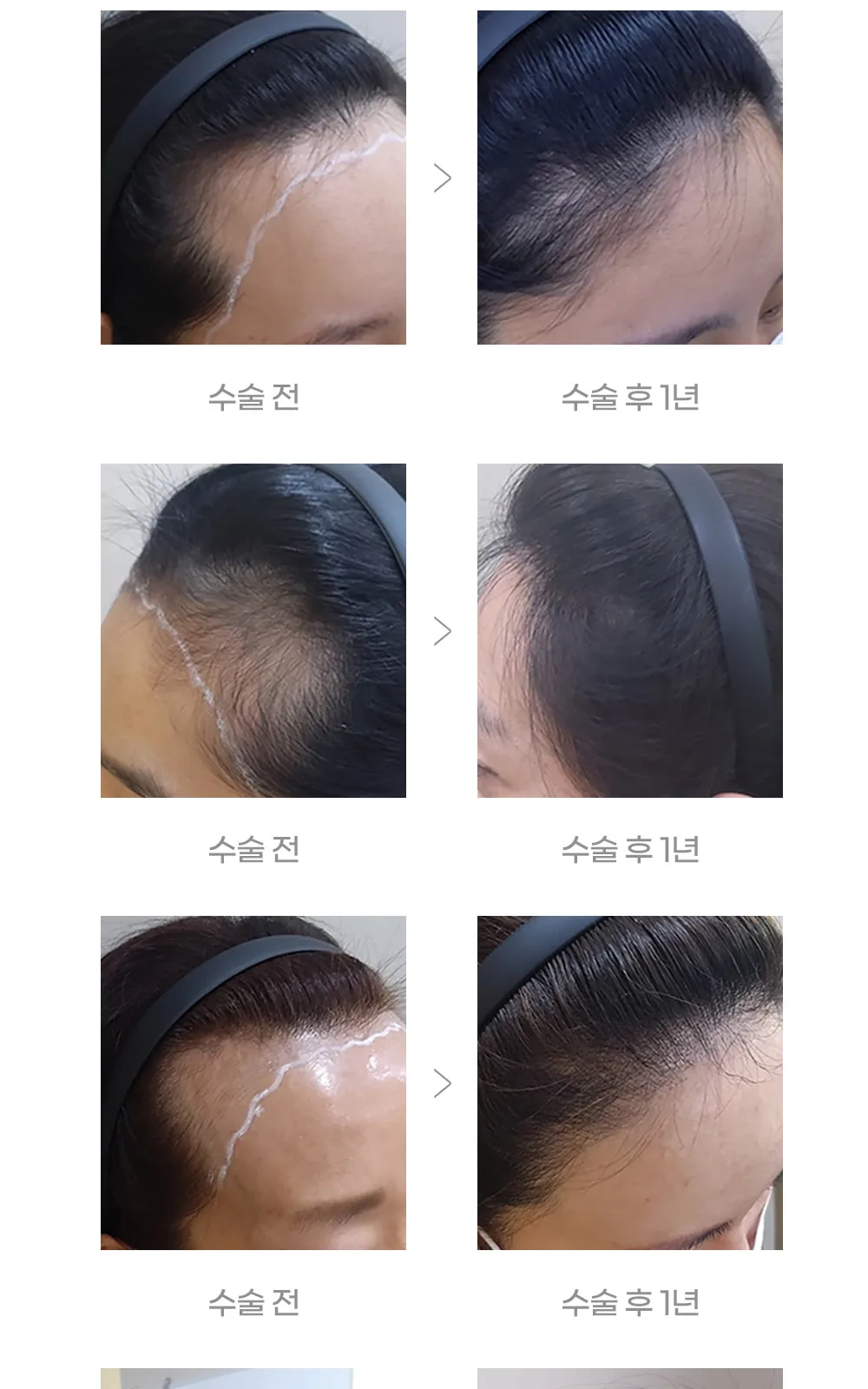 시술 상세 10