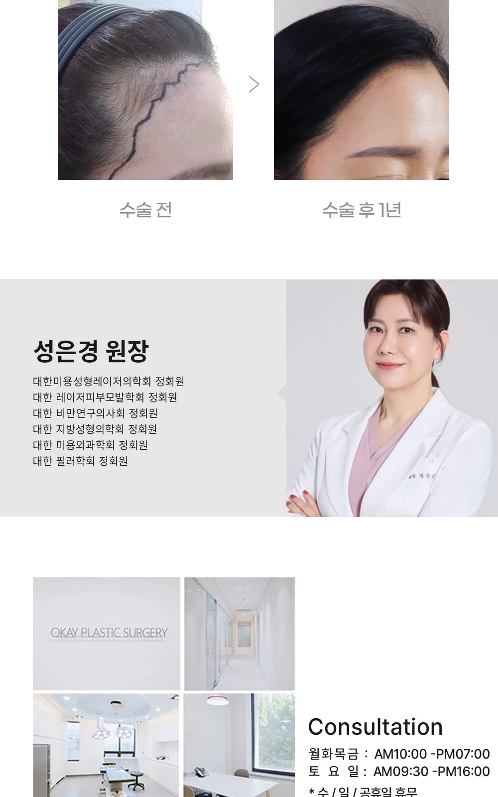 시술 상세 11