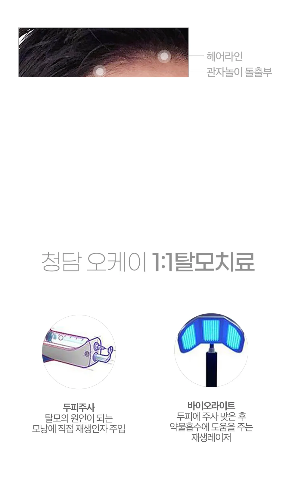 시술 상세 7