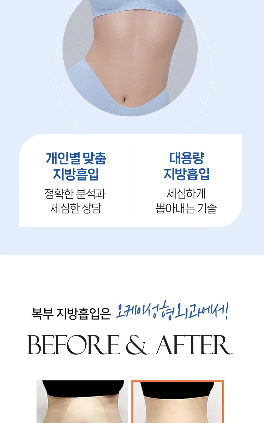 시술 상세 3