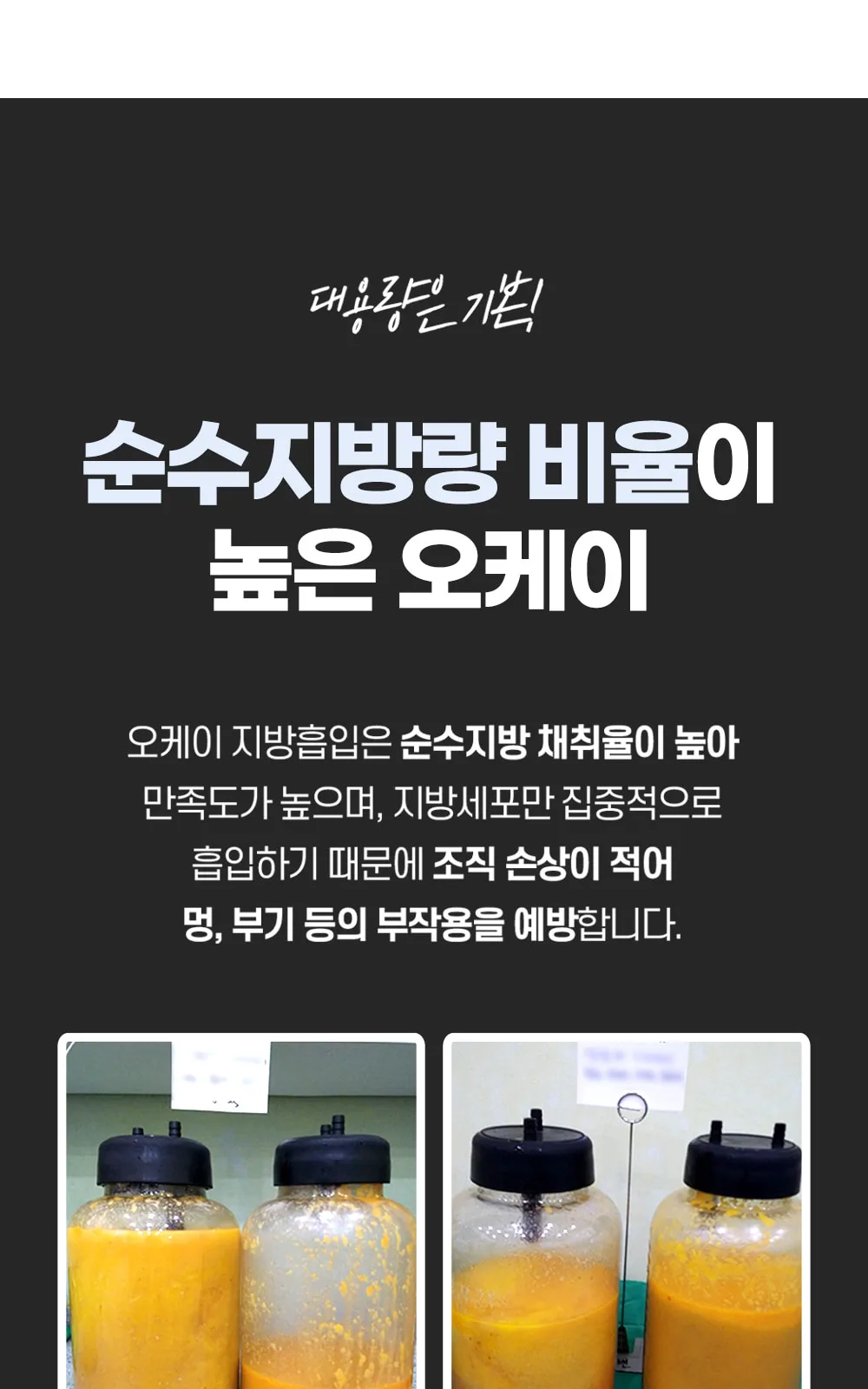시술 상세 5