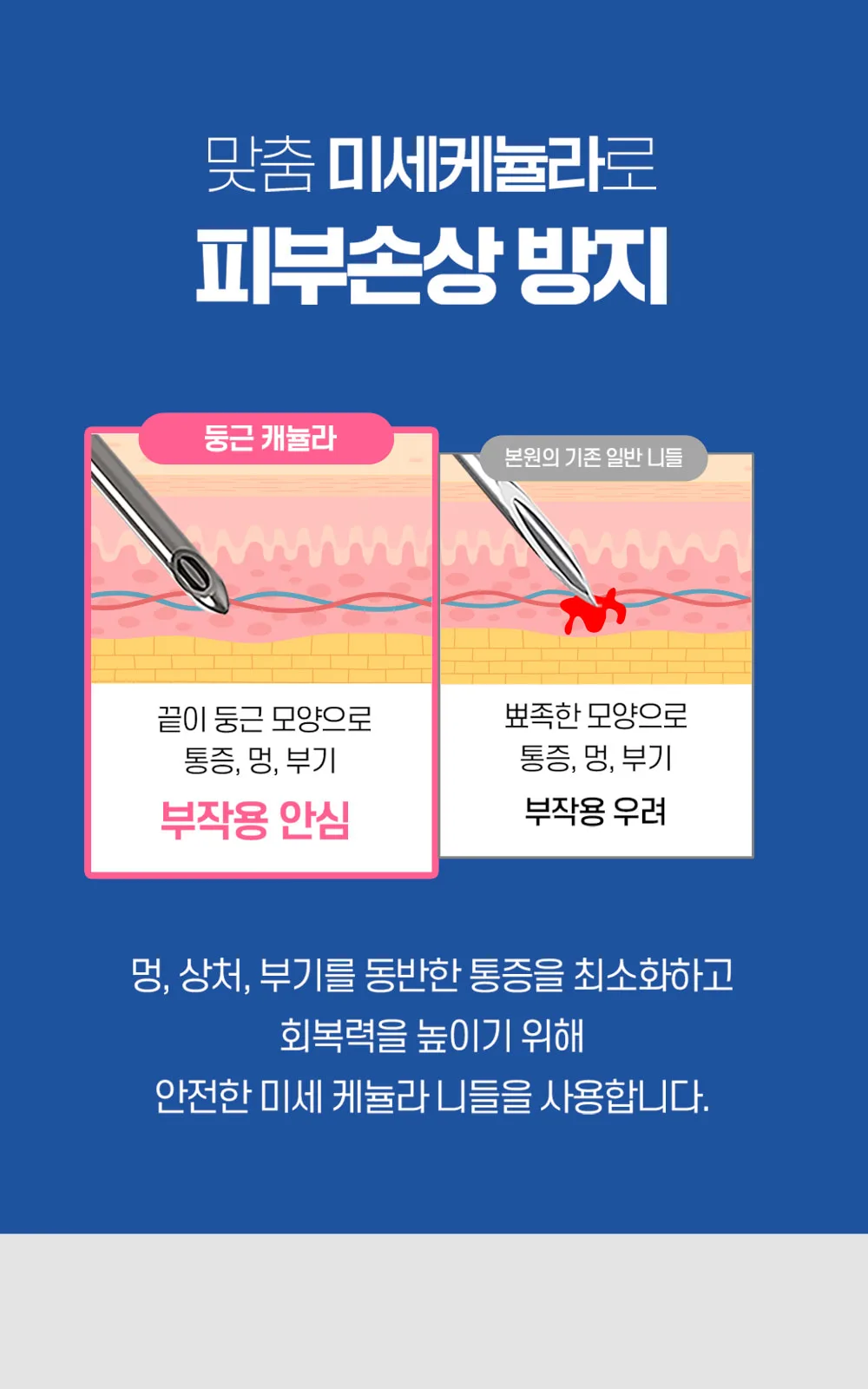 시술 상세 8