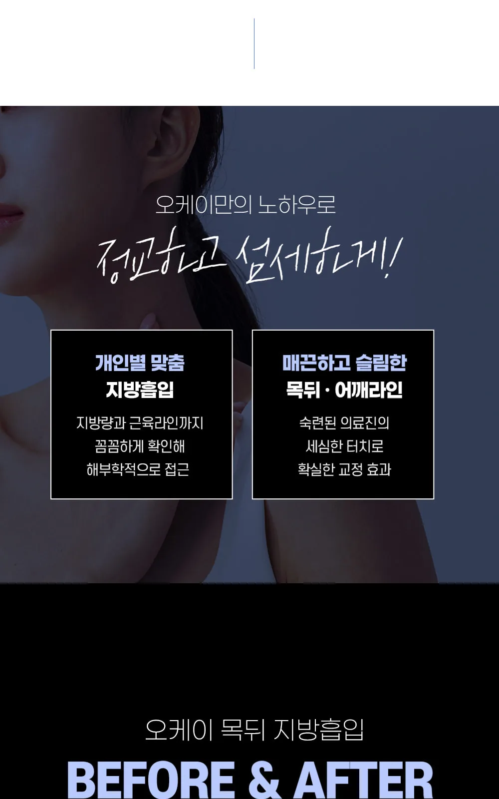 시술 상세 4