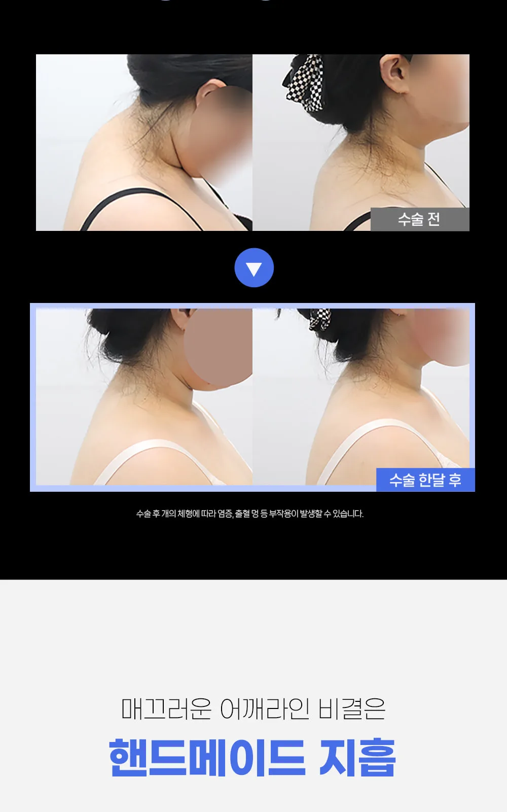 시술 상세 5